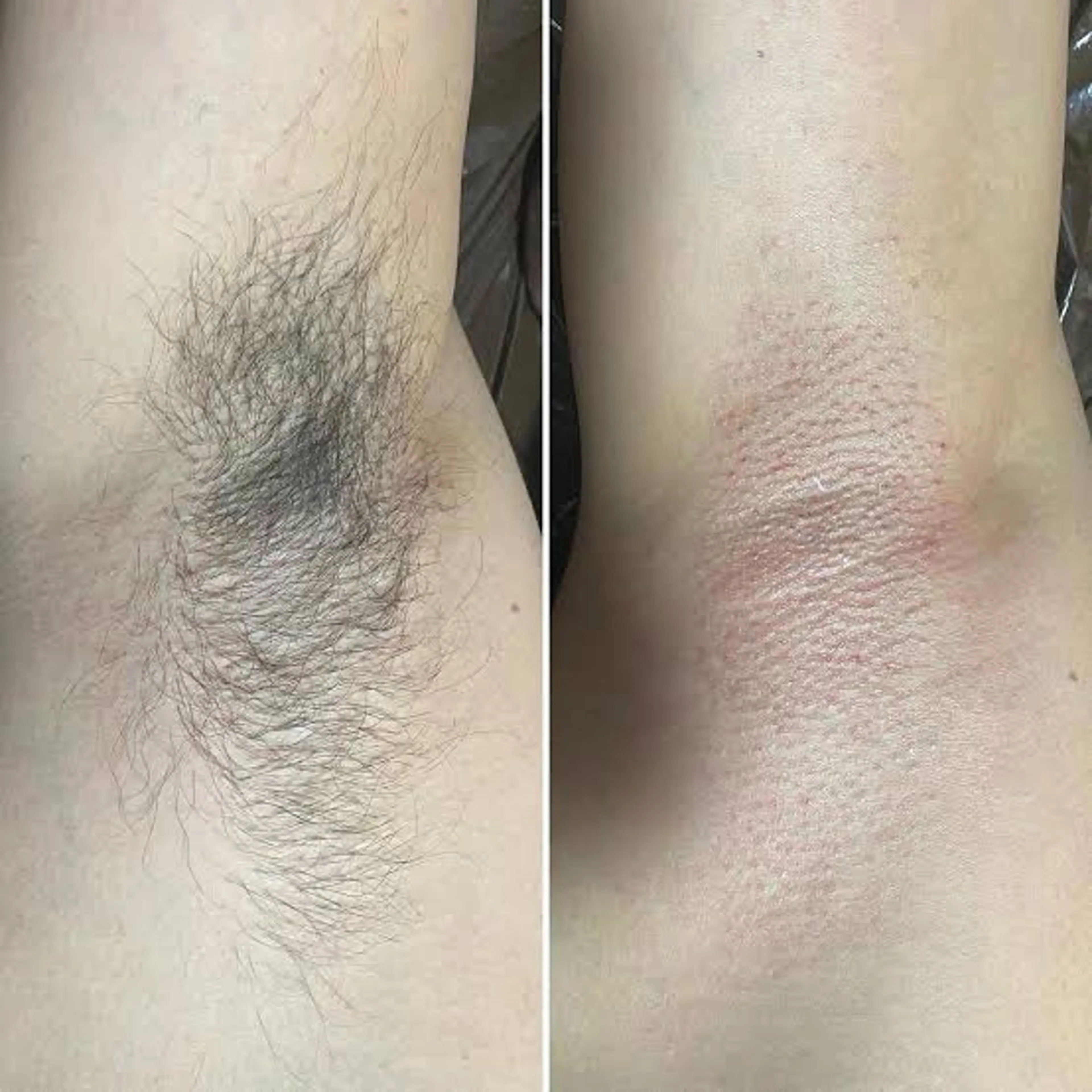 エステサロンmarry所属・エステサロン marryのエステ・リラクイメージ