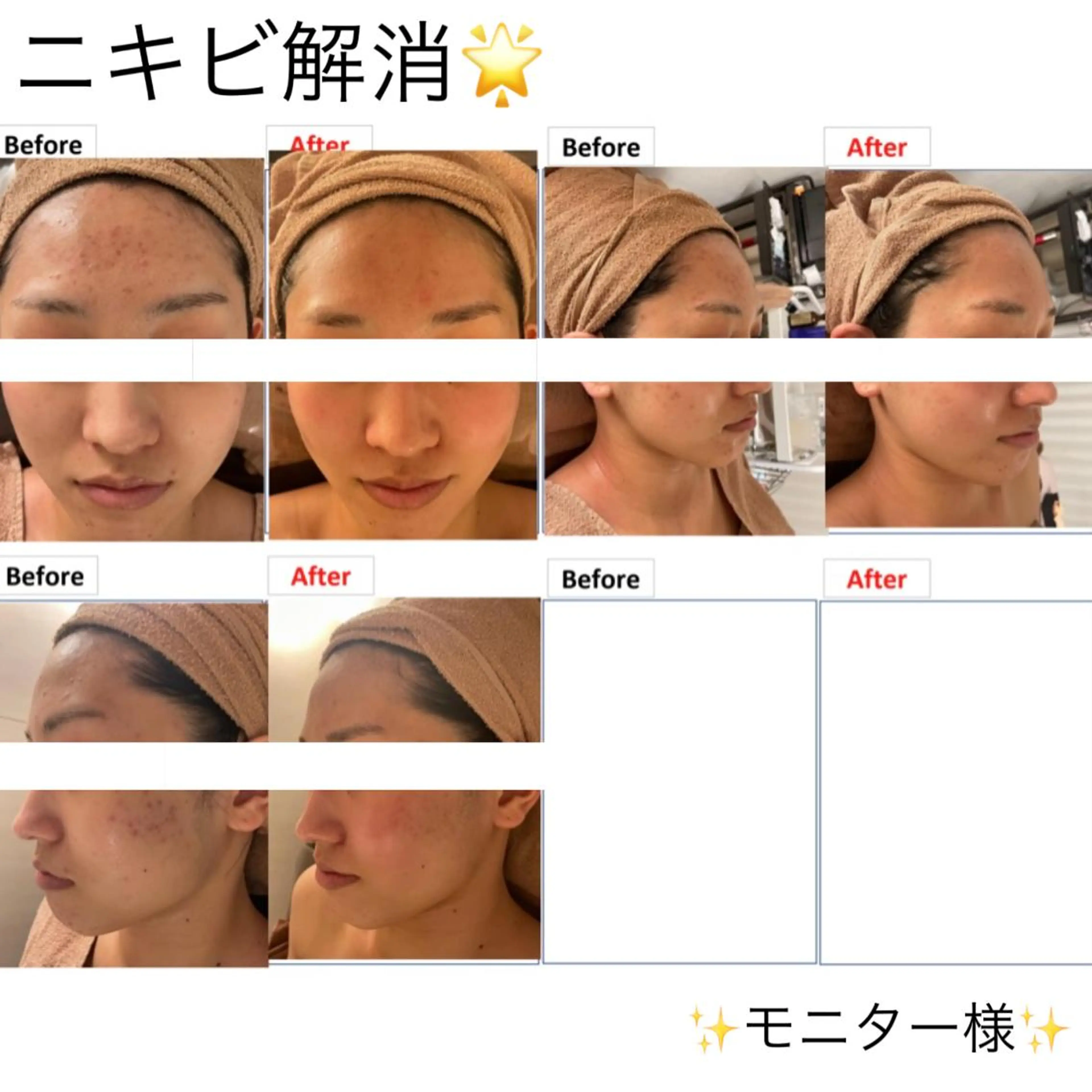 レイビス 渋谷店のエステ・リラクイメージ