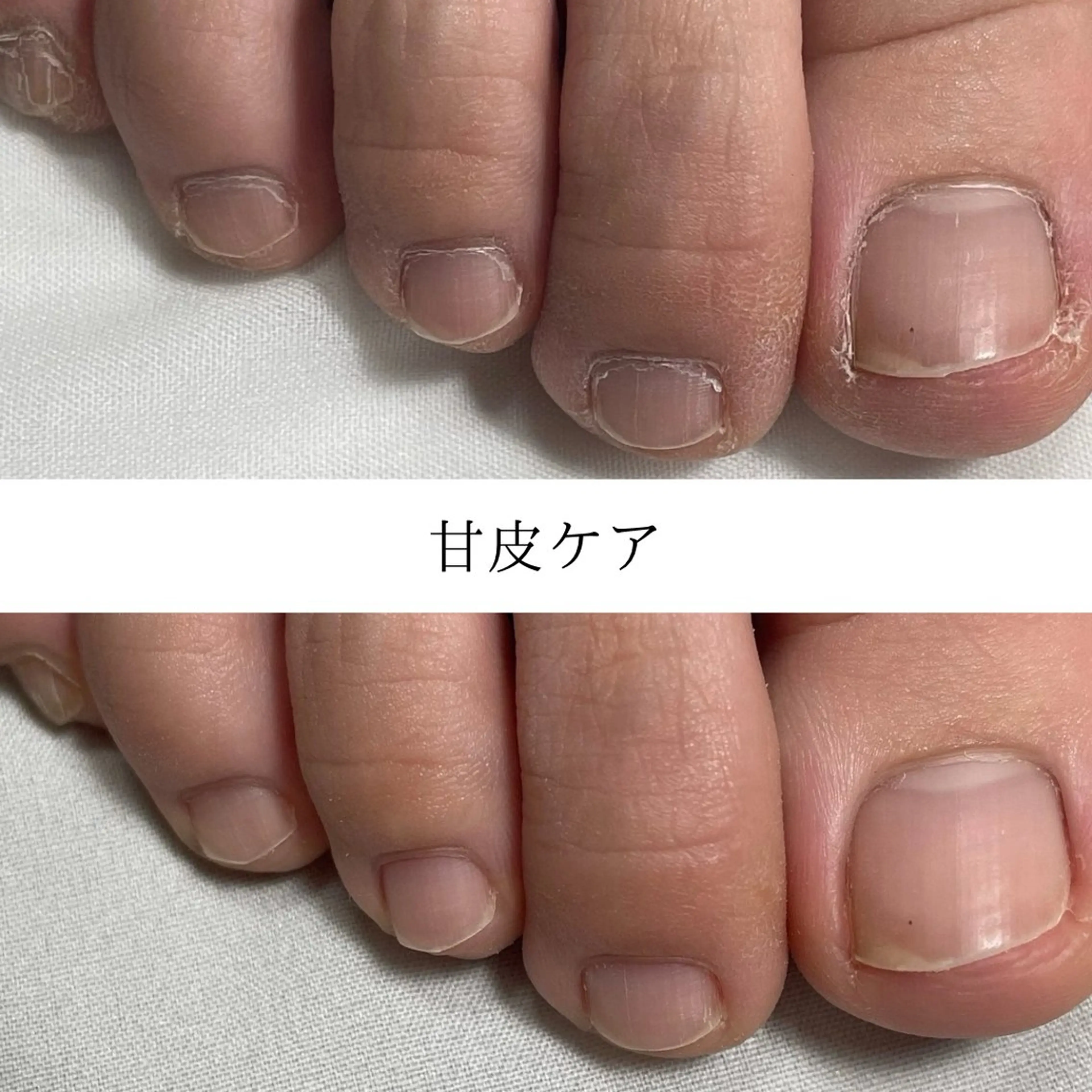 フットケア（甘皮ケア/お爪整/クリアマニキュア）の写真