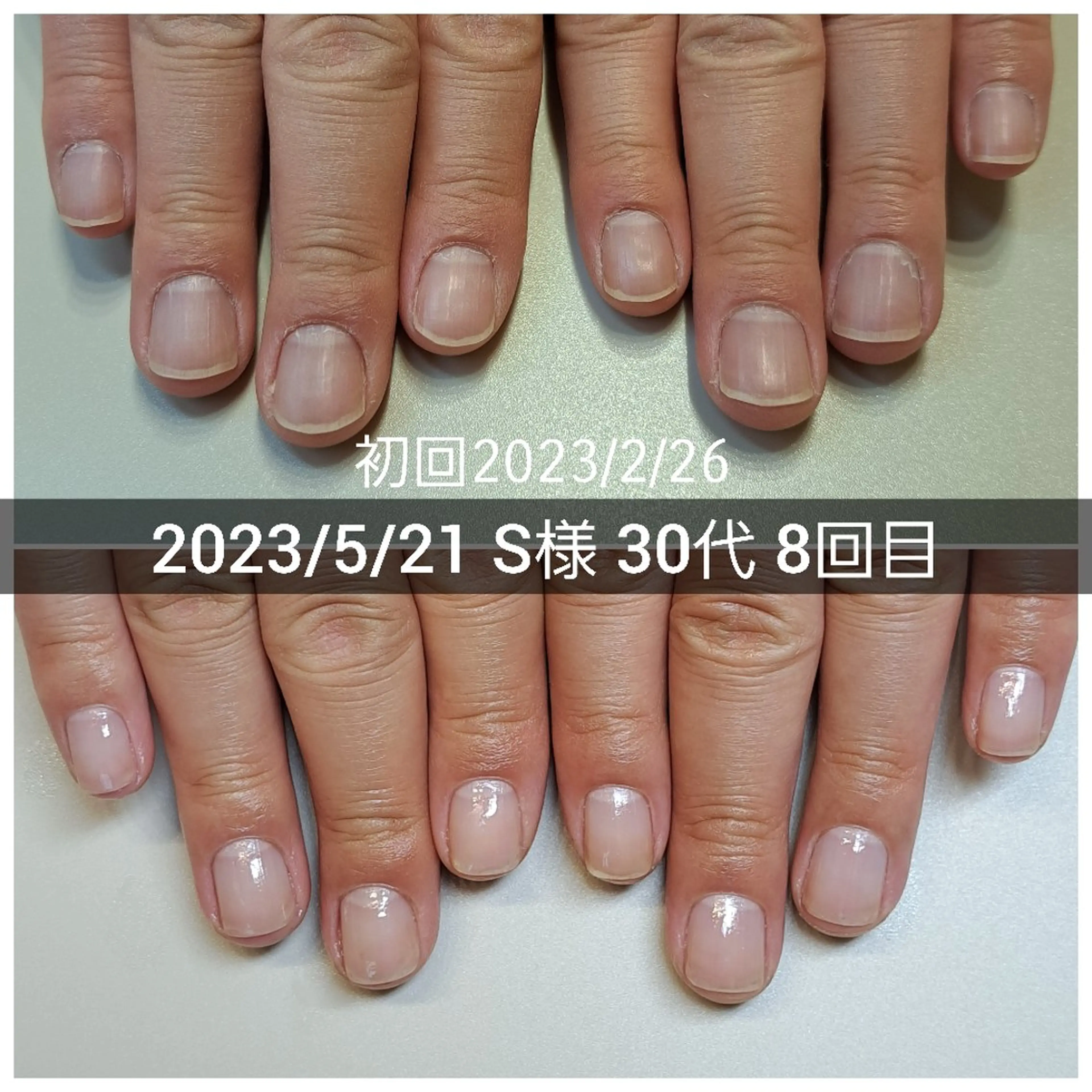 ネイル ジェルネイル ハンドケア AKT Beauty所属・AKT Beauty ドライヘッドスパのエステ・リラクイメージ