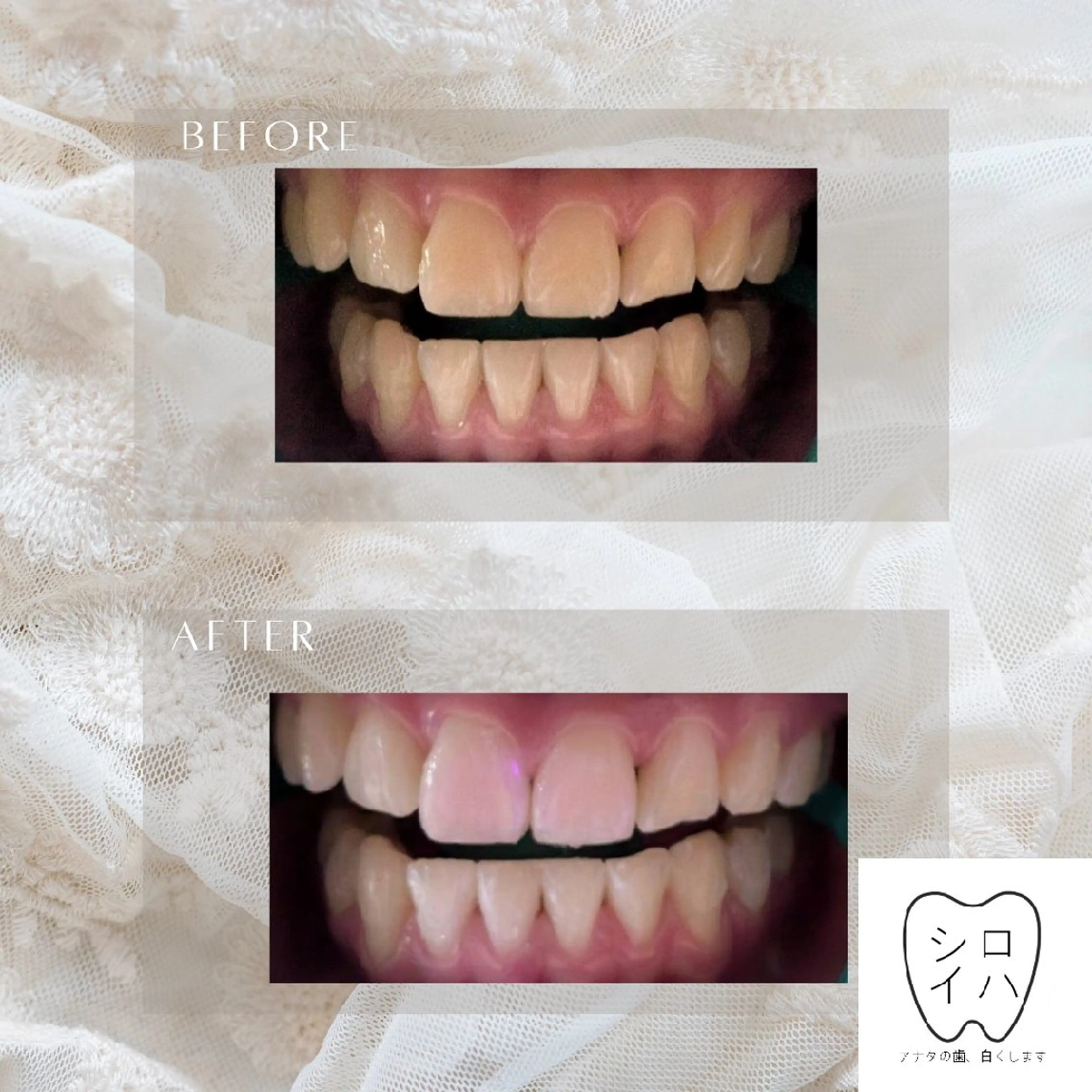 ホワイトニングサロン シロイハ所属・歯を白くしたい方🦷 シロイハのその他イメージ