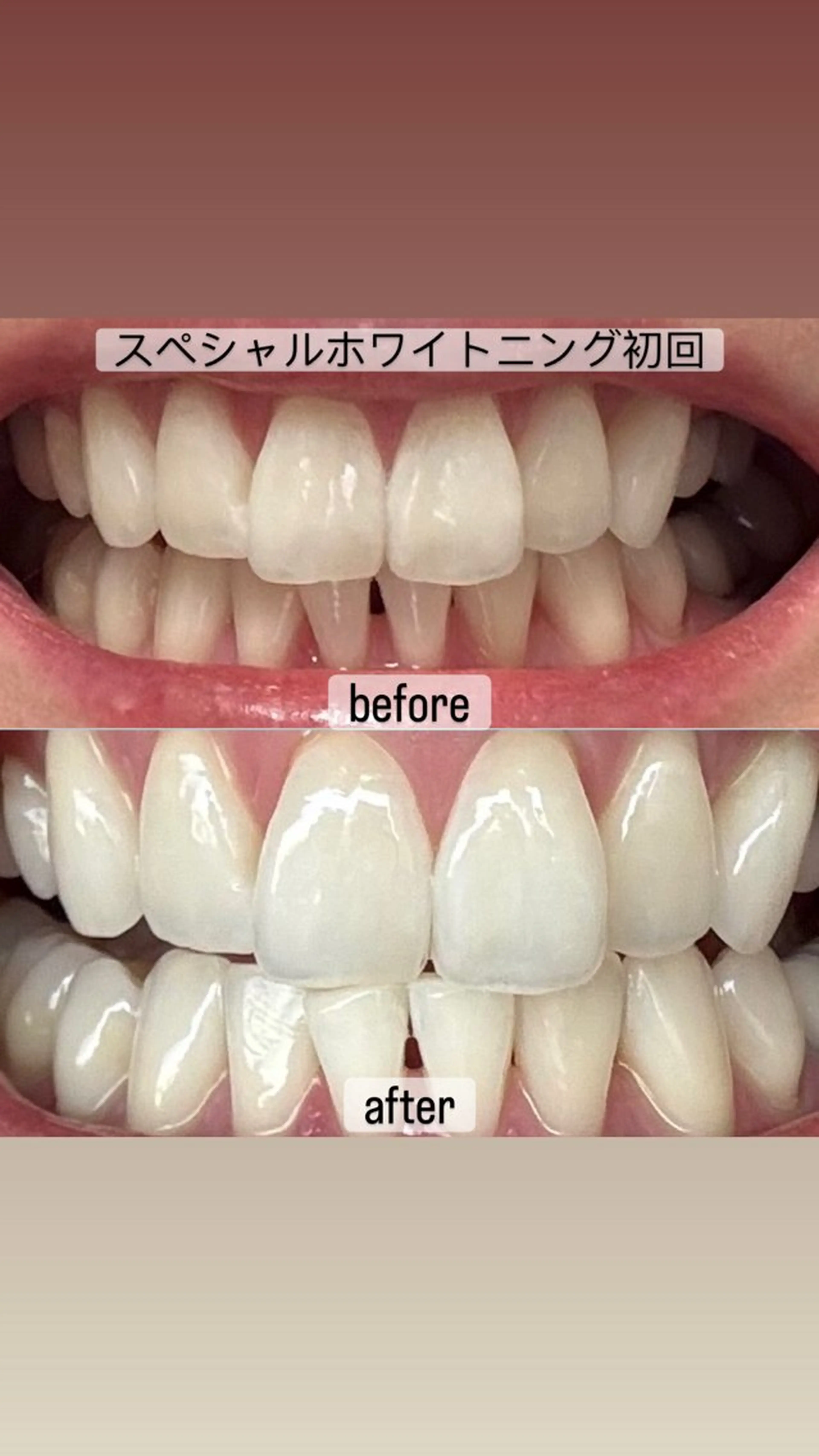 whitening salon yatto.所属・ホワイトニングサロン yatto.のその他イメージ