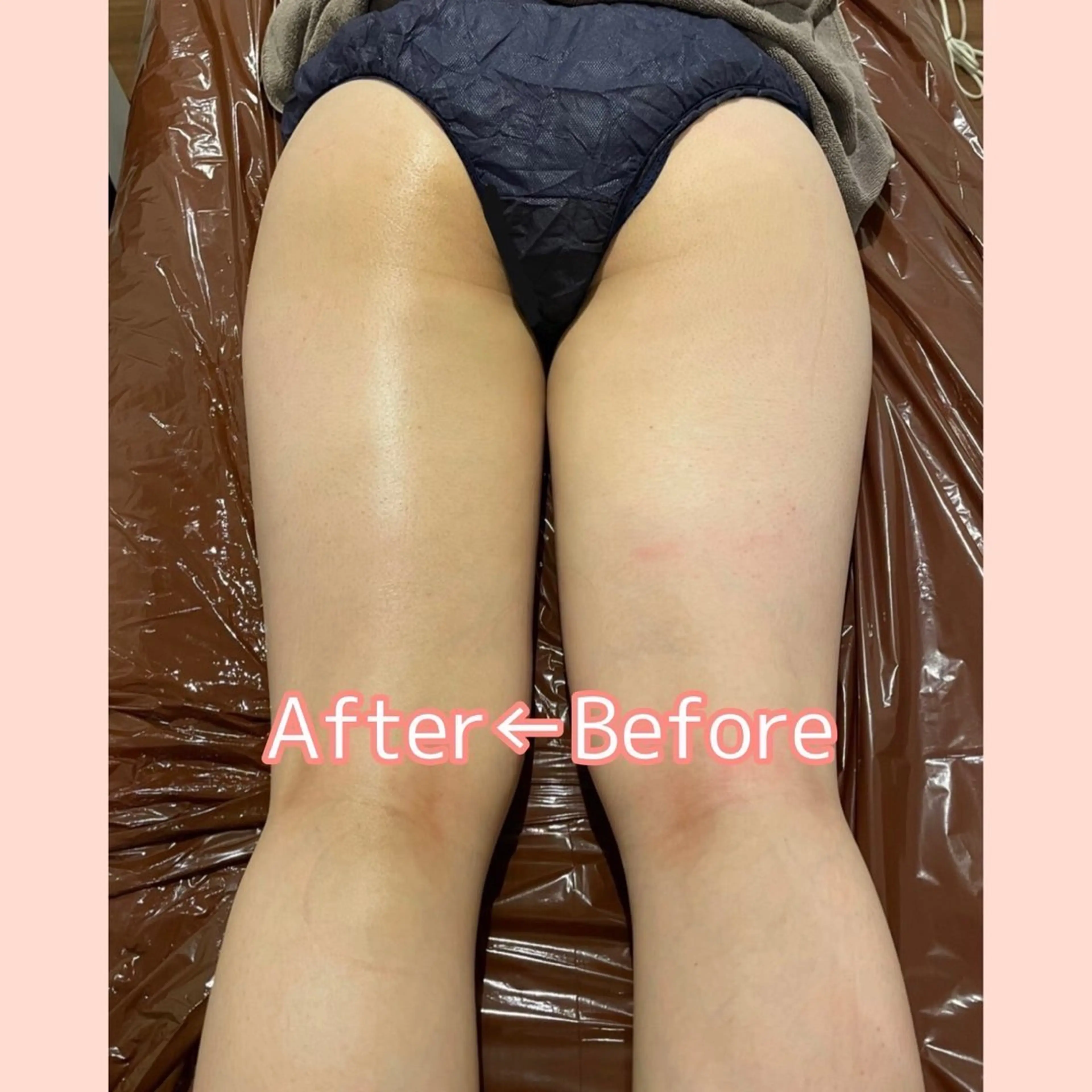 ル・プランタン🌿 鈴木のエステ・リラクイメージ