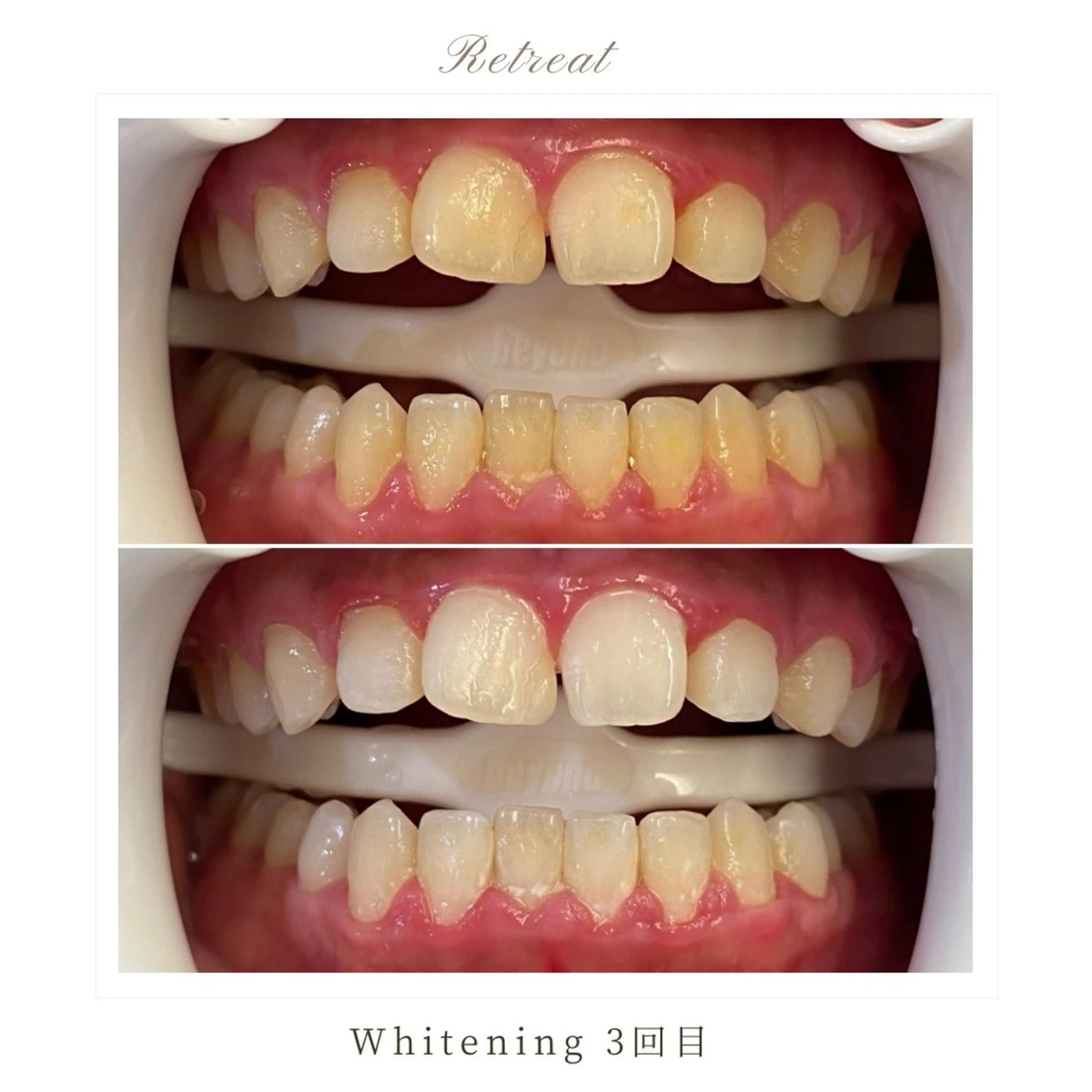 Retreatリトリート所属・歯科医院提携 Retreatのエステ・リラクイメージ