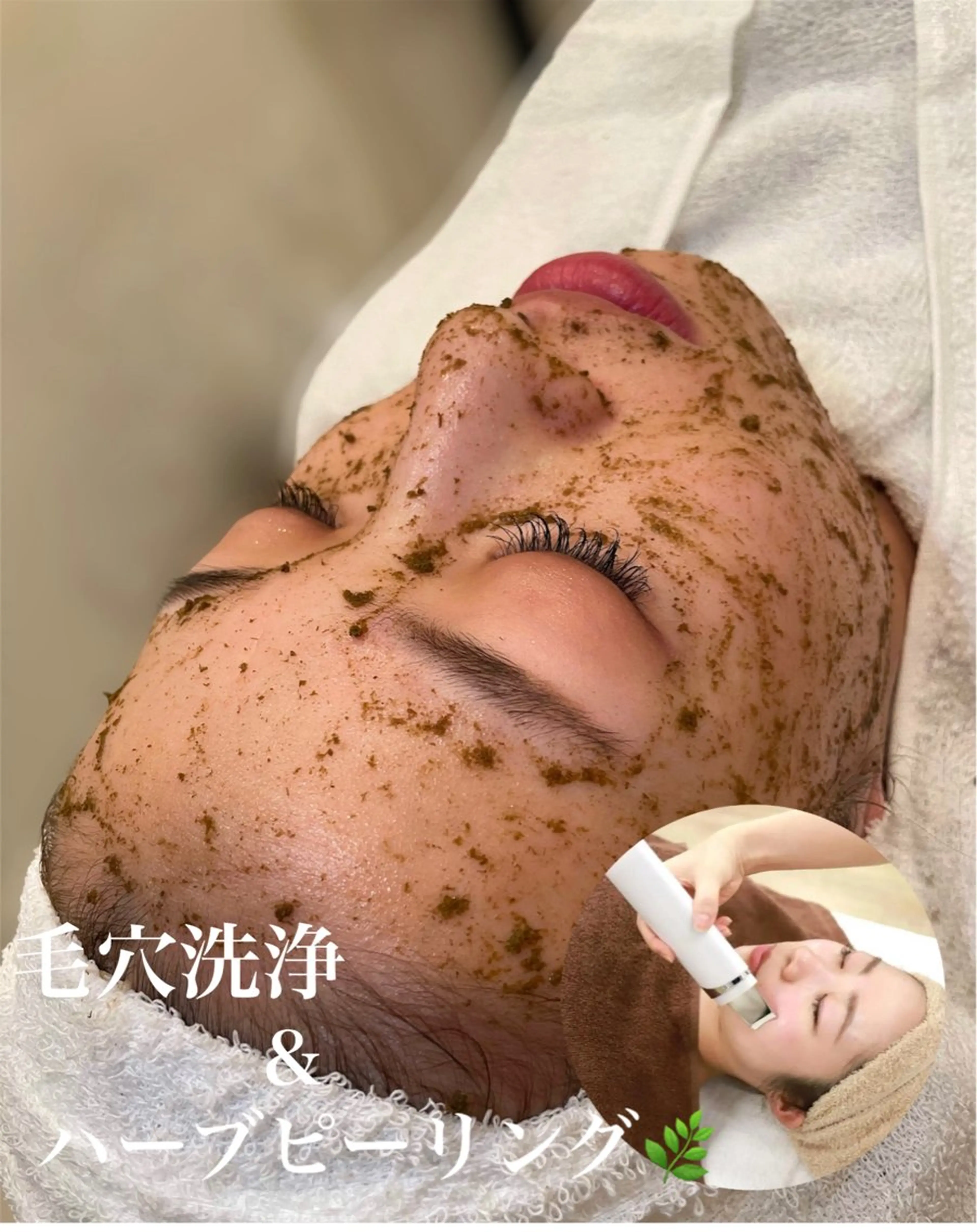 【人気No1☆】韓国最新美容”塗る金の糸”☆ハーブピーリング+超音波毛穴洗浄の写真