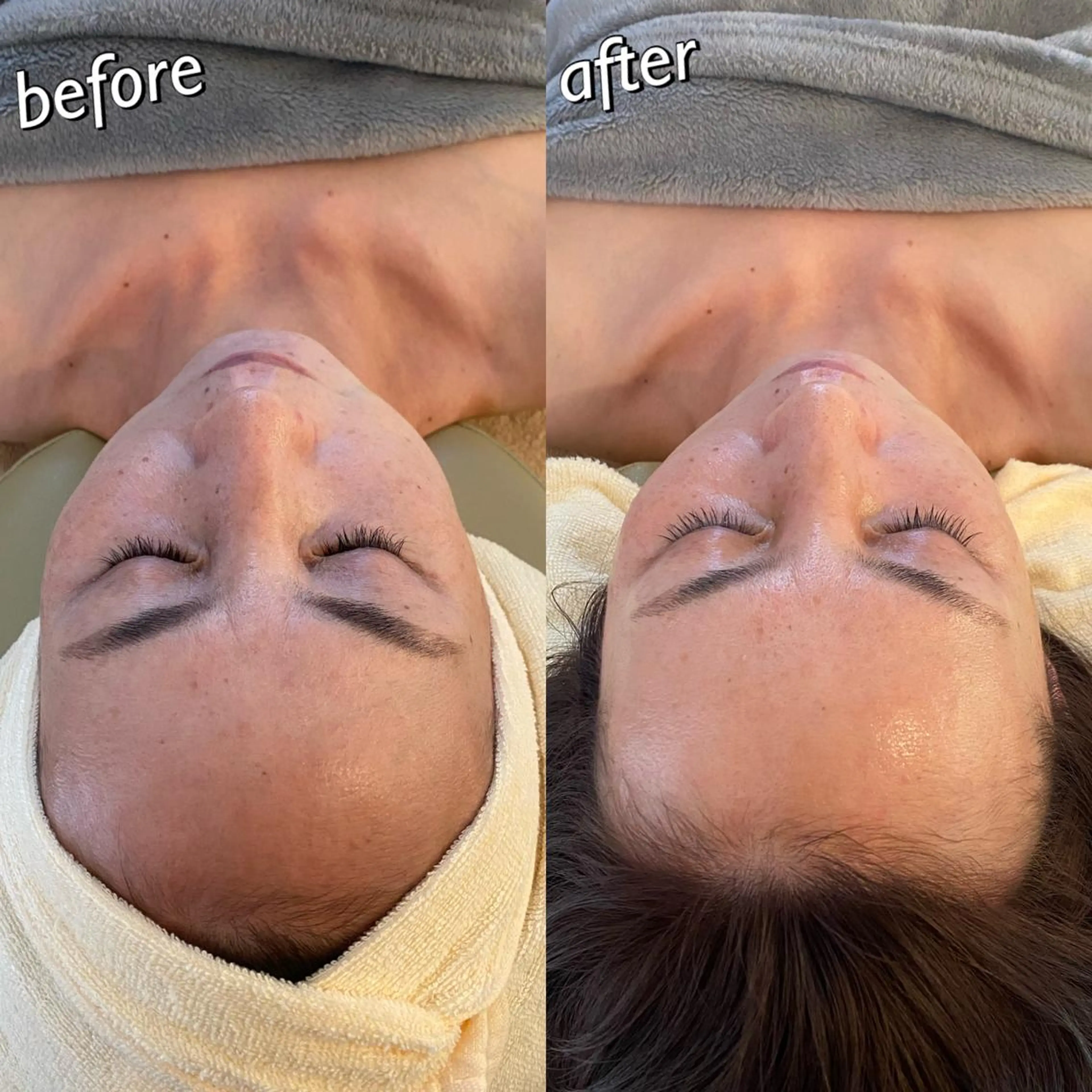 うなじ脱毛/美肌脱毛 LABELのエステ・リラクイメージ