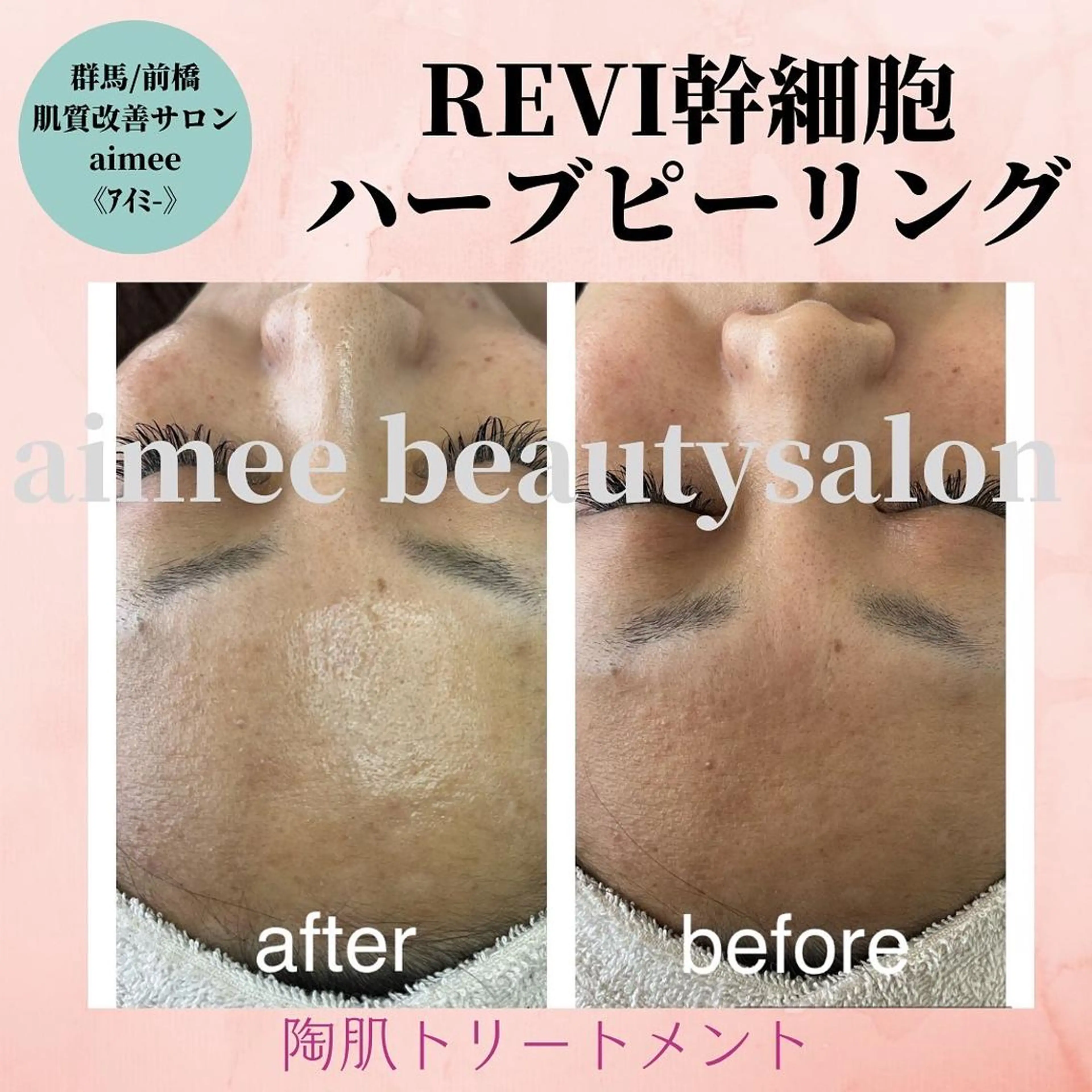 エステ aimee　肌質改善サロン【アイミー】所属・肌質改善サロン aimee｜アイミーのエステ・リラクイメージ