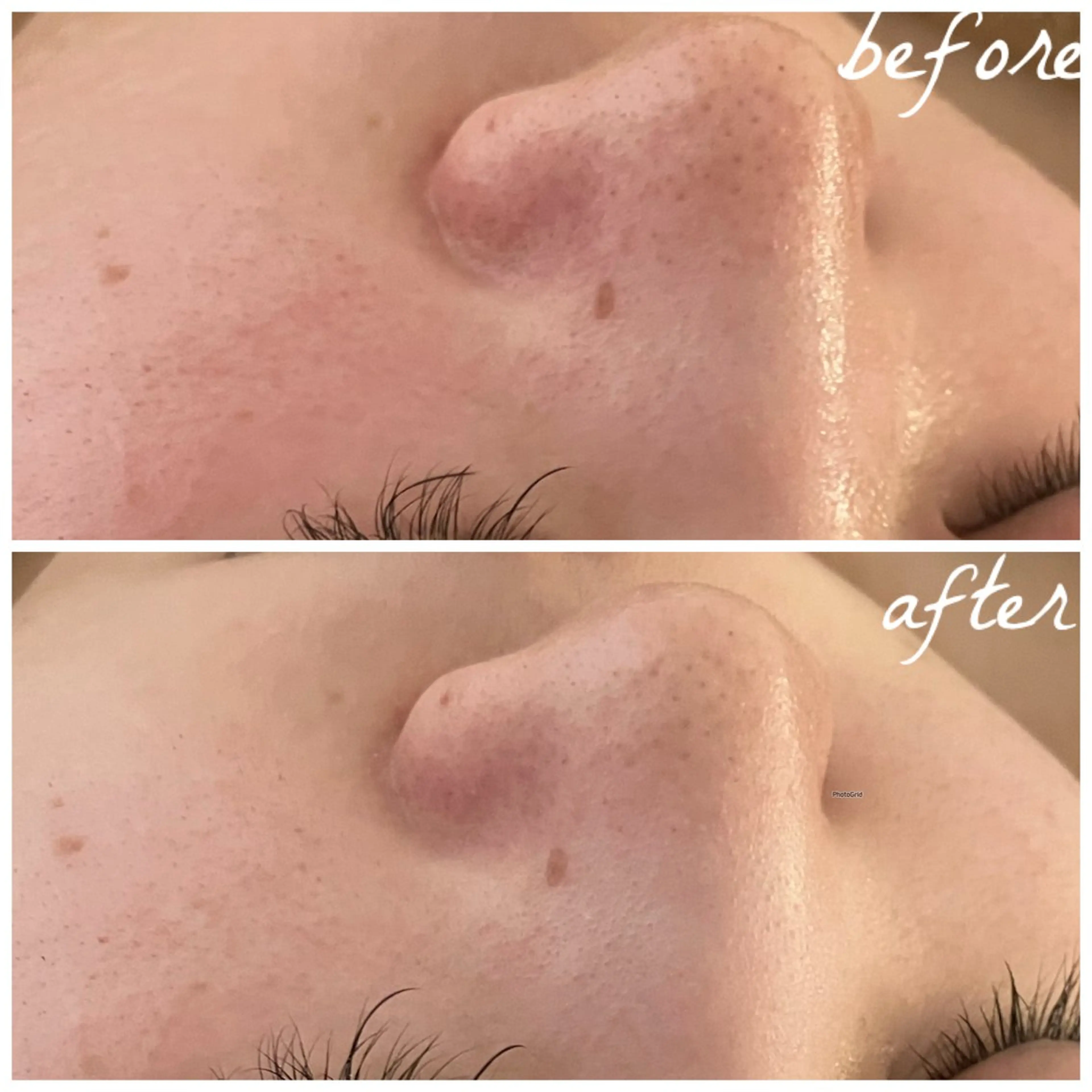 メンズ エステ メナード岐阜茜部 杉浦のエステ・リラクイメージ