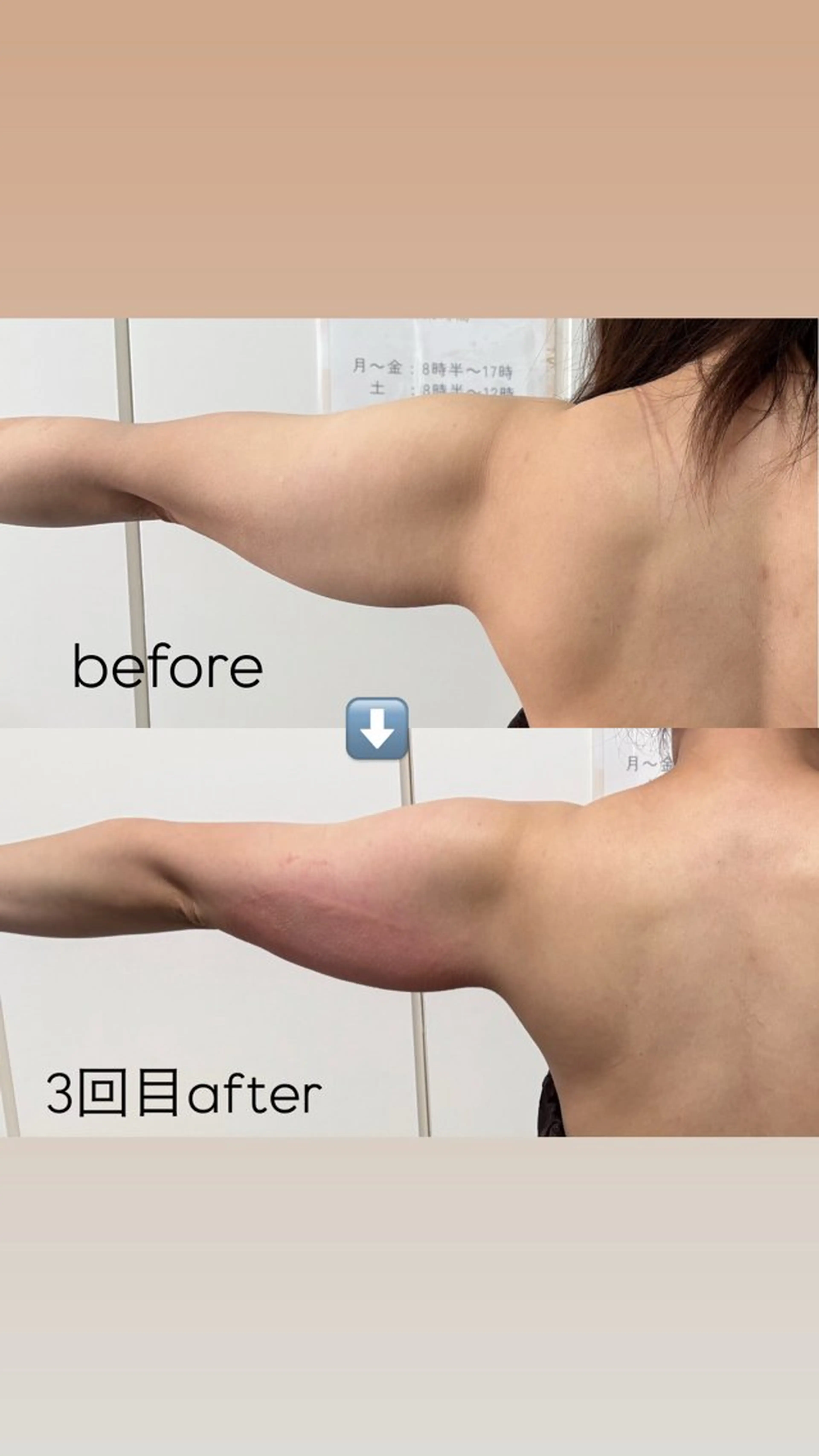 Miiju.所属・Miiju. 石巻市 脂肪冷却  鈴木のエステ・リラクイメージ