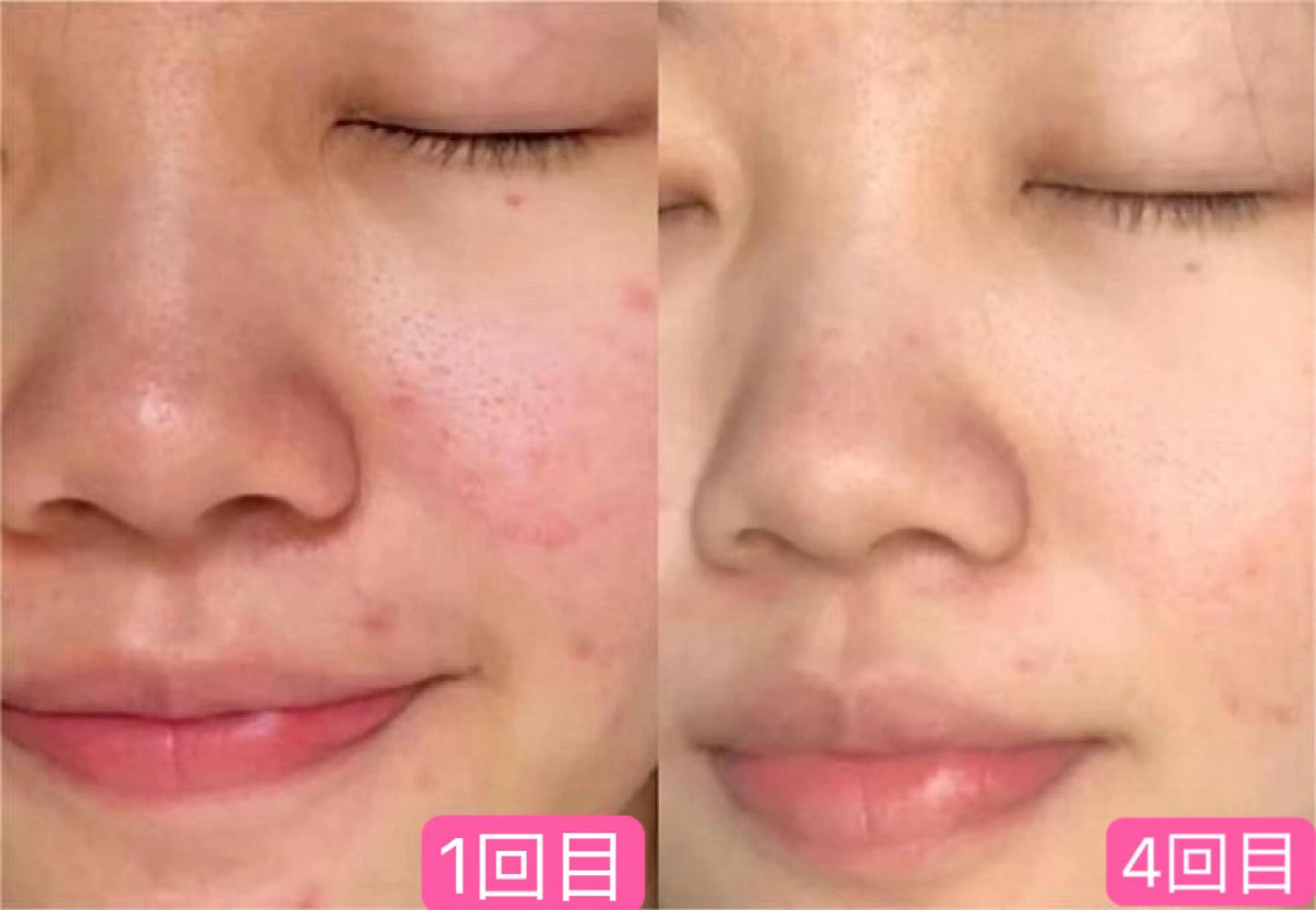 Nature Souce毛穴専門店のその他イメージ