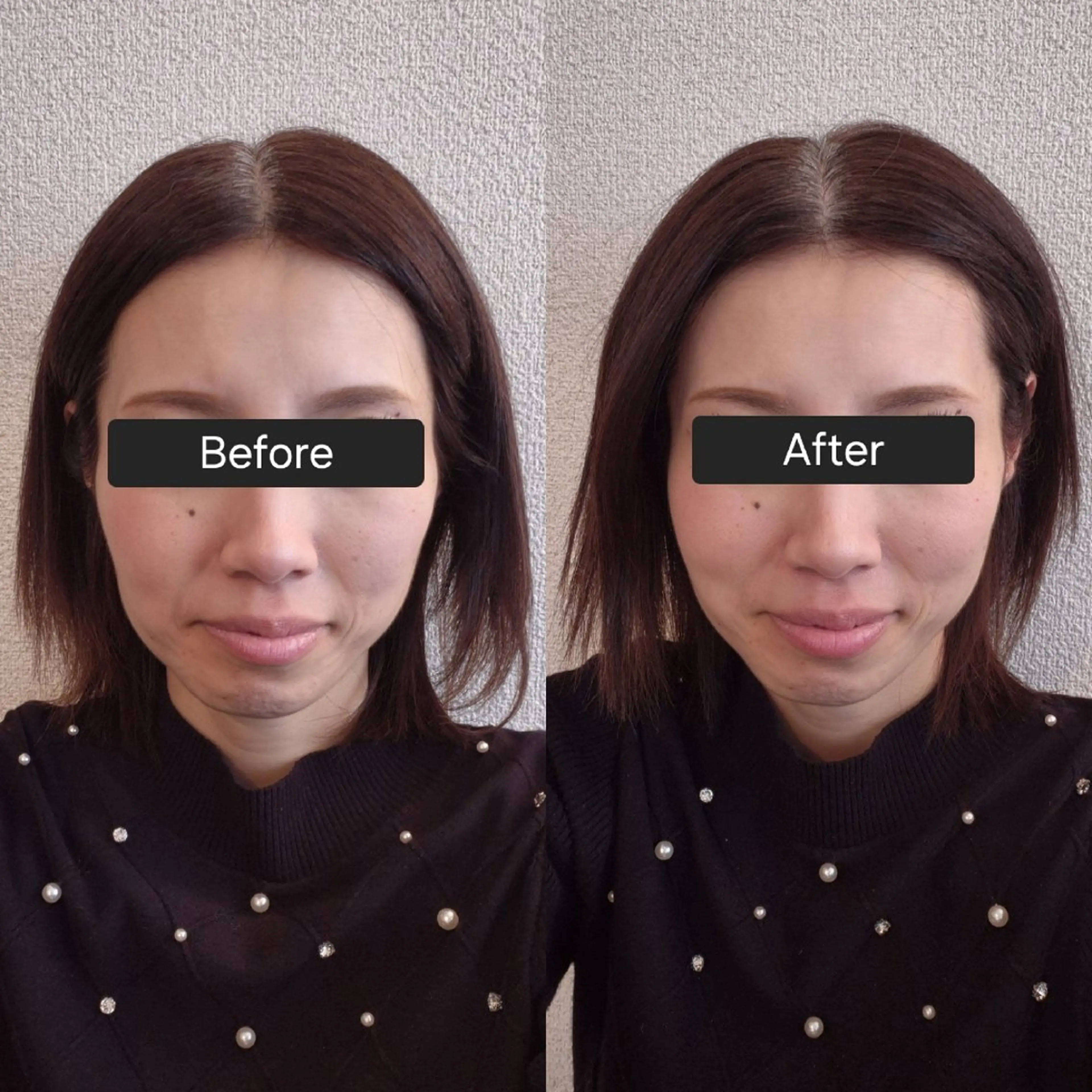 小顔矯正 LNのエステ・リラクイメージ