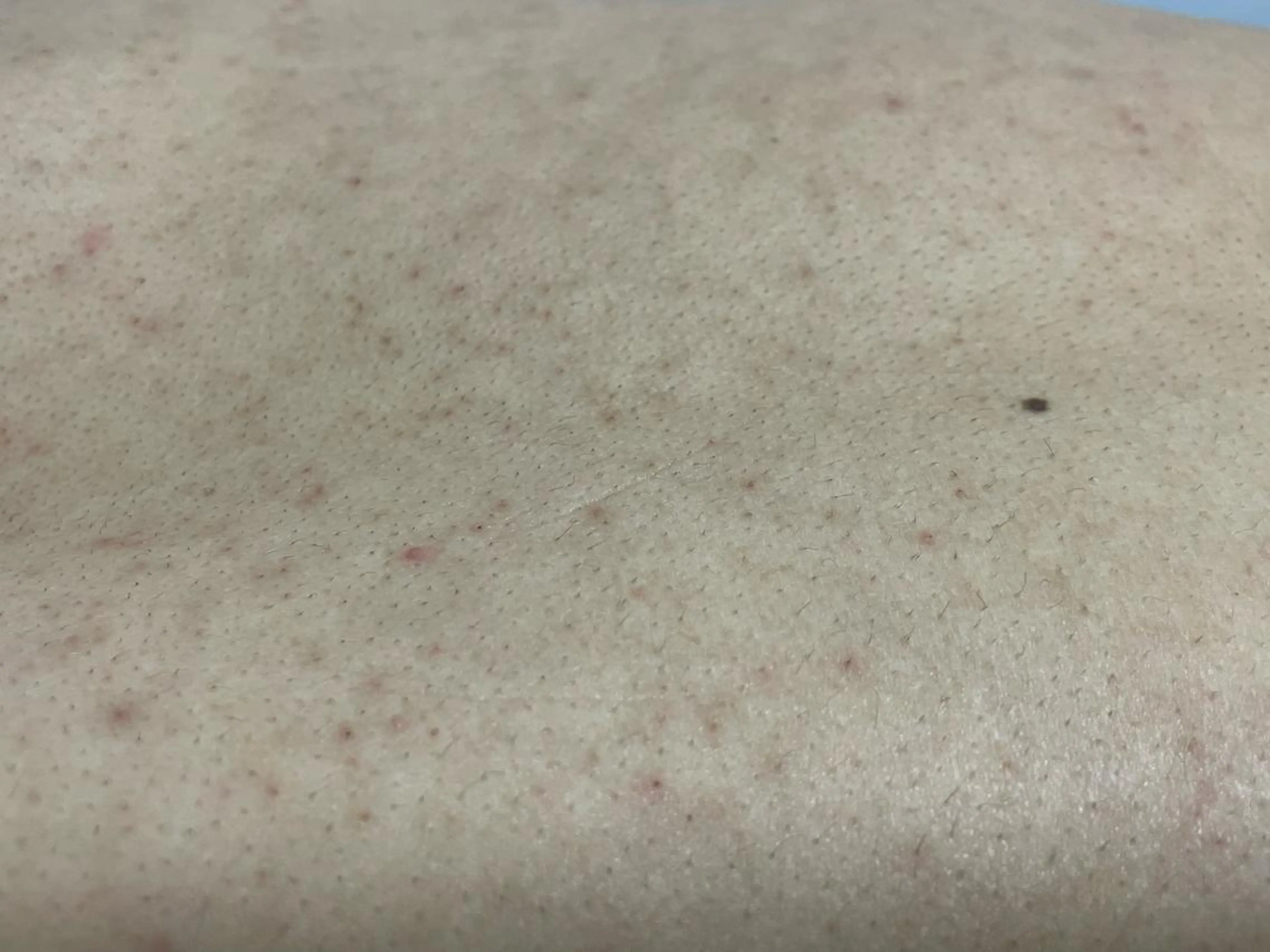 メンズ キッズ 脱毛SALON RaYNiCKのエステ・リラクイメージ