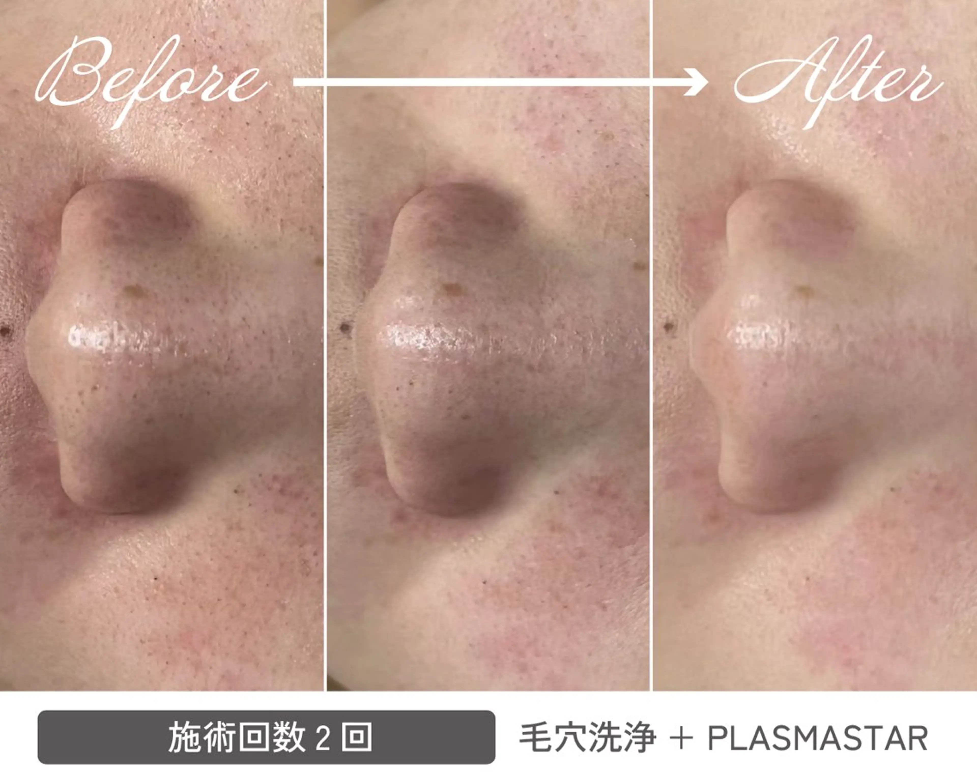 エステ リラク emire beauty salon所属・村上 玲奈のエステ・リラクイメージ