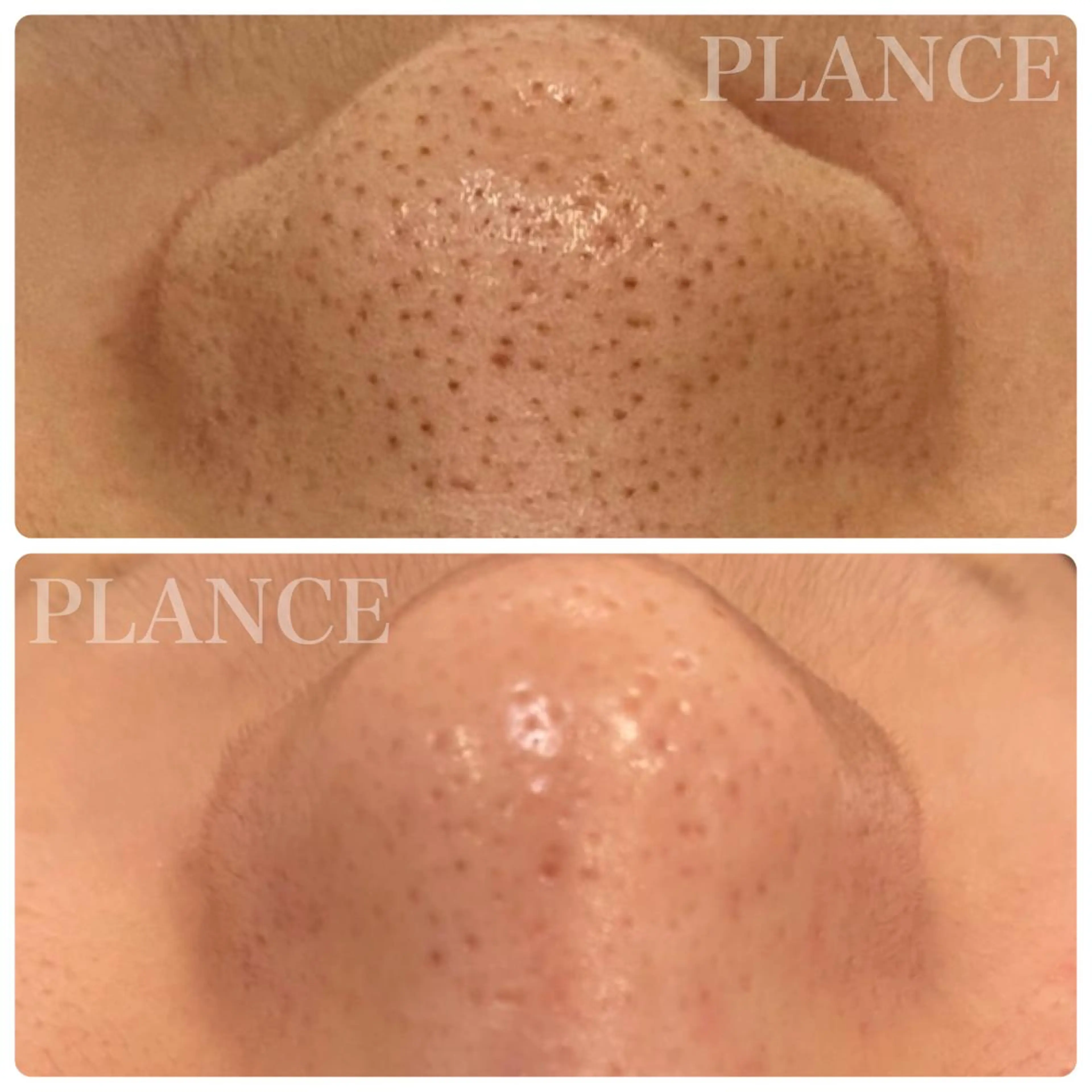 エステ フェイシャル専門 肌質改善/プランスのエステ・リラクイメージ