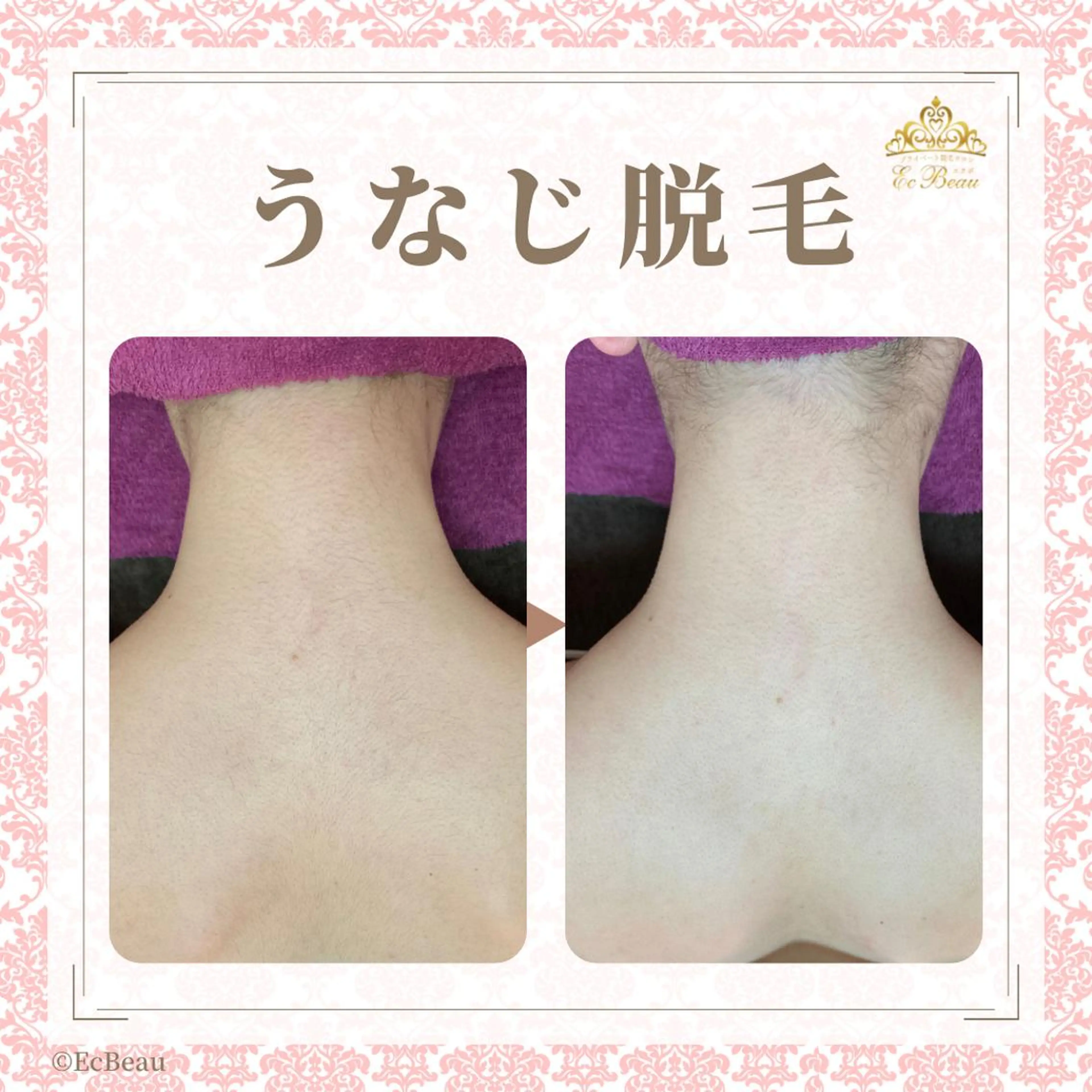 脱毛サロン　エクボ ワダのエステ・リラクイメージ