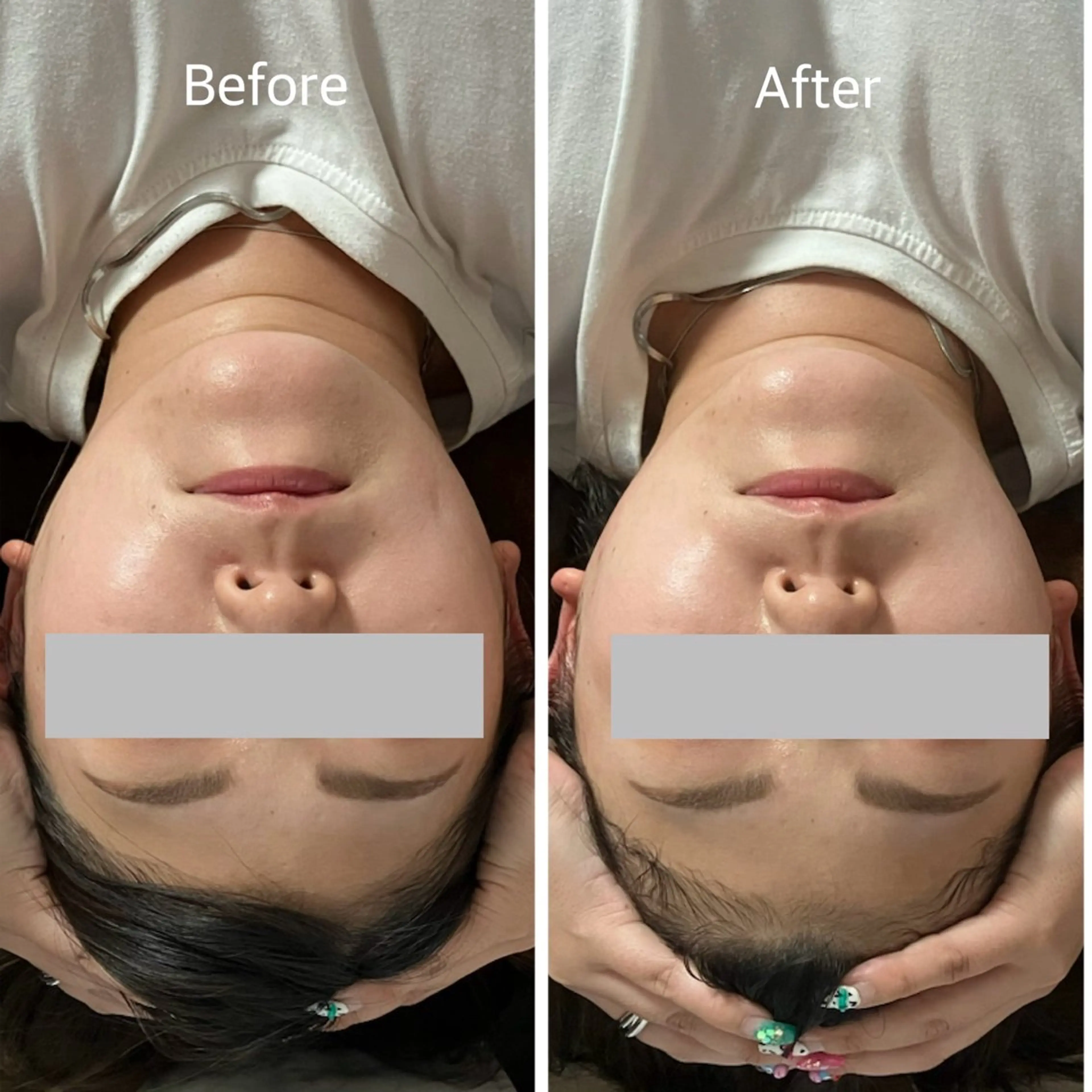 【小顔・リフトアップ・美肌】フェイシャルケアの写真