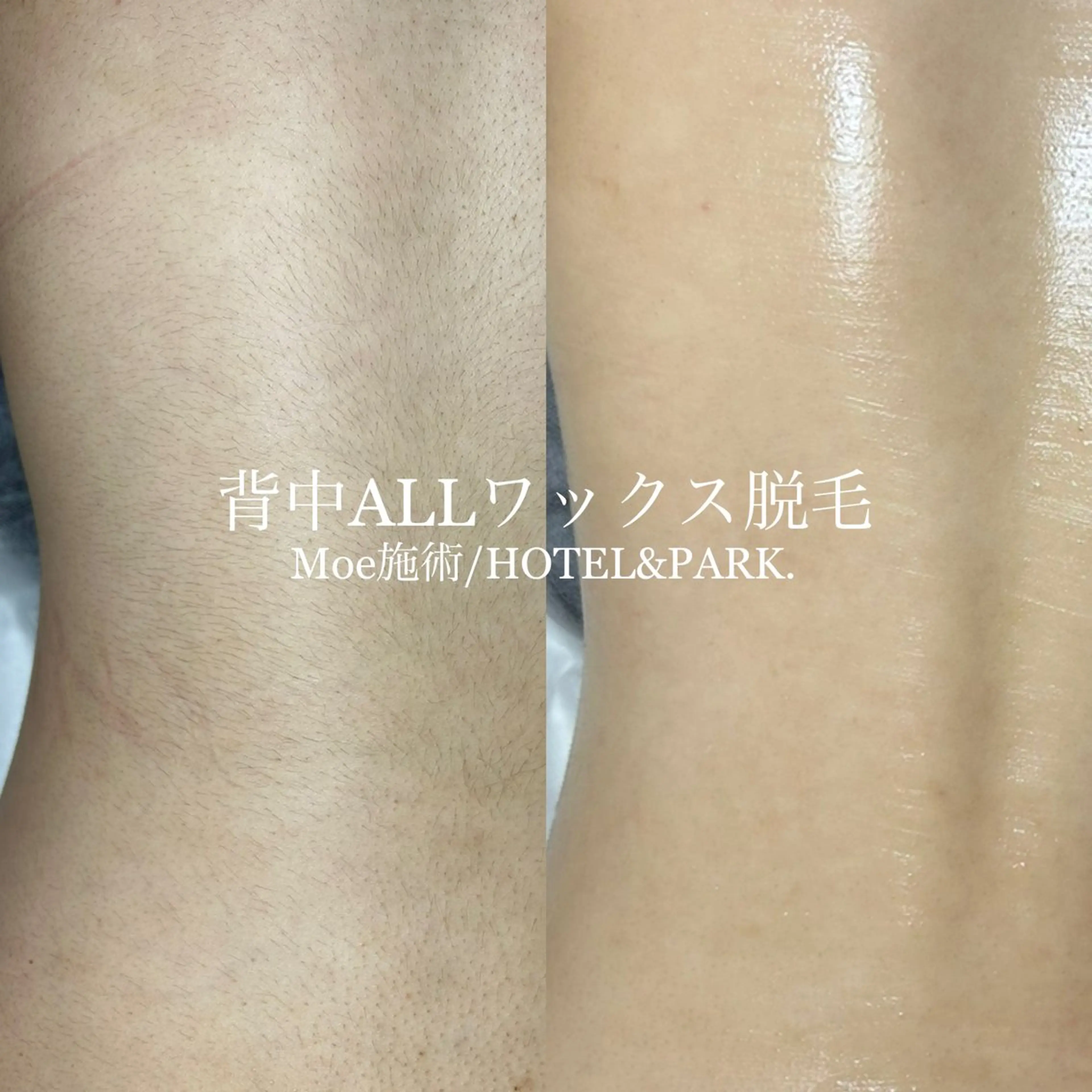 HOTEL&PARK .Moeワックス脱毛のエステ・リラクイメージ