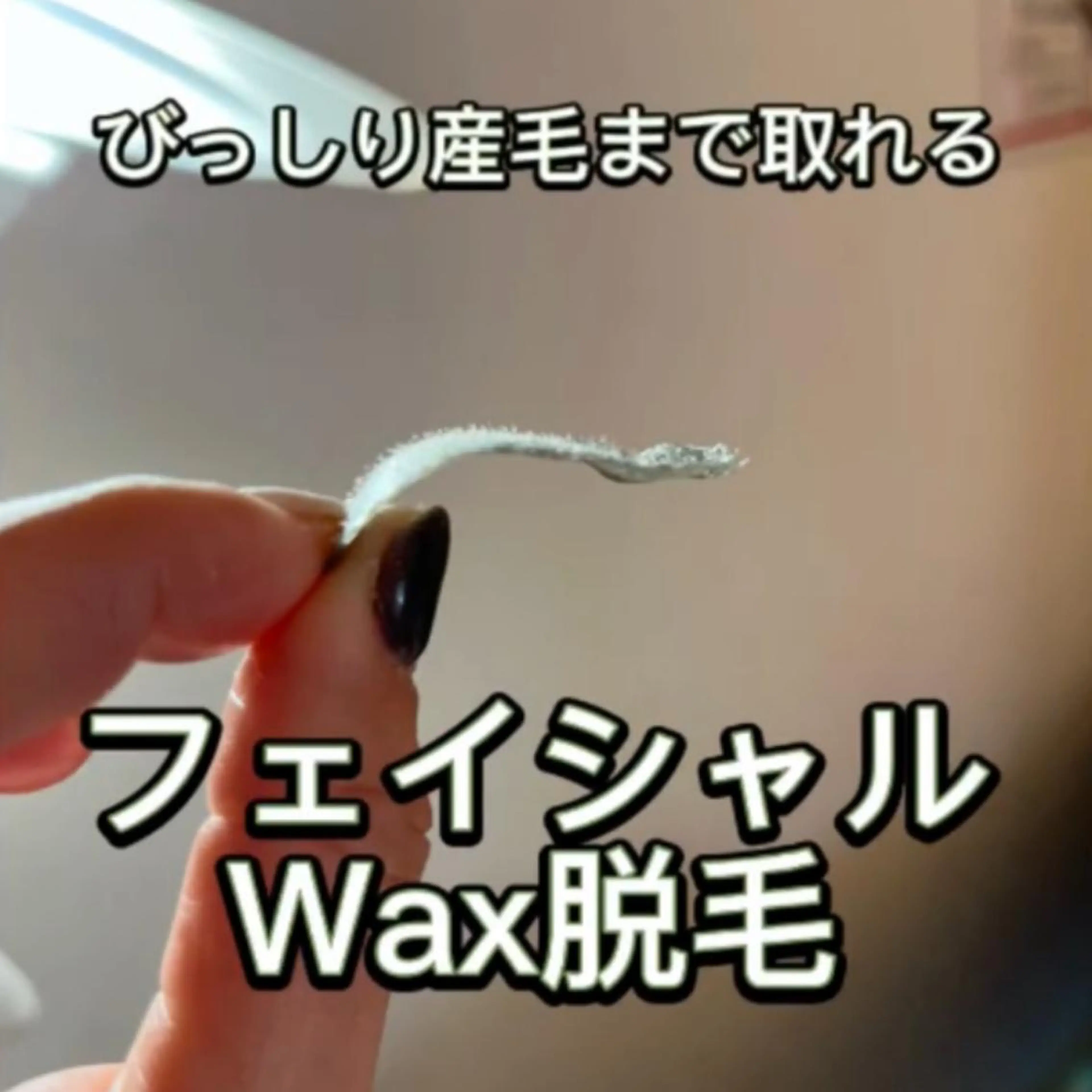 【人気急上昇　ミニモ限定✨】ツルスベお顔全体スーパーフードWAX脱毛（沈静・保湿パック込み）※男性予約可※ヒゲ以外の部分の写真