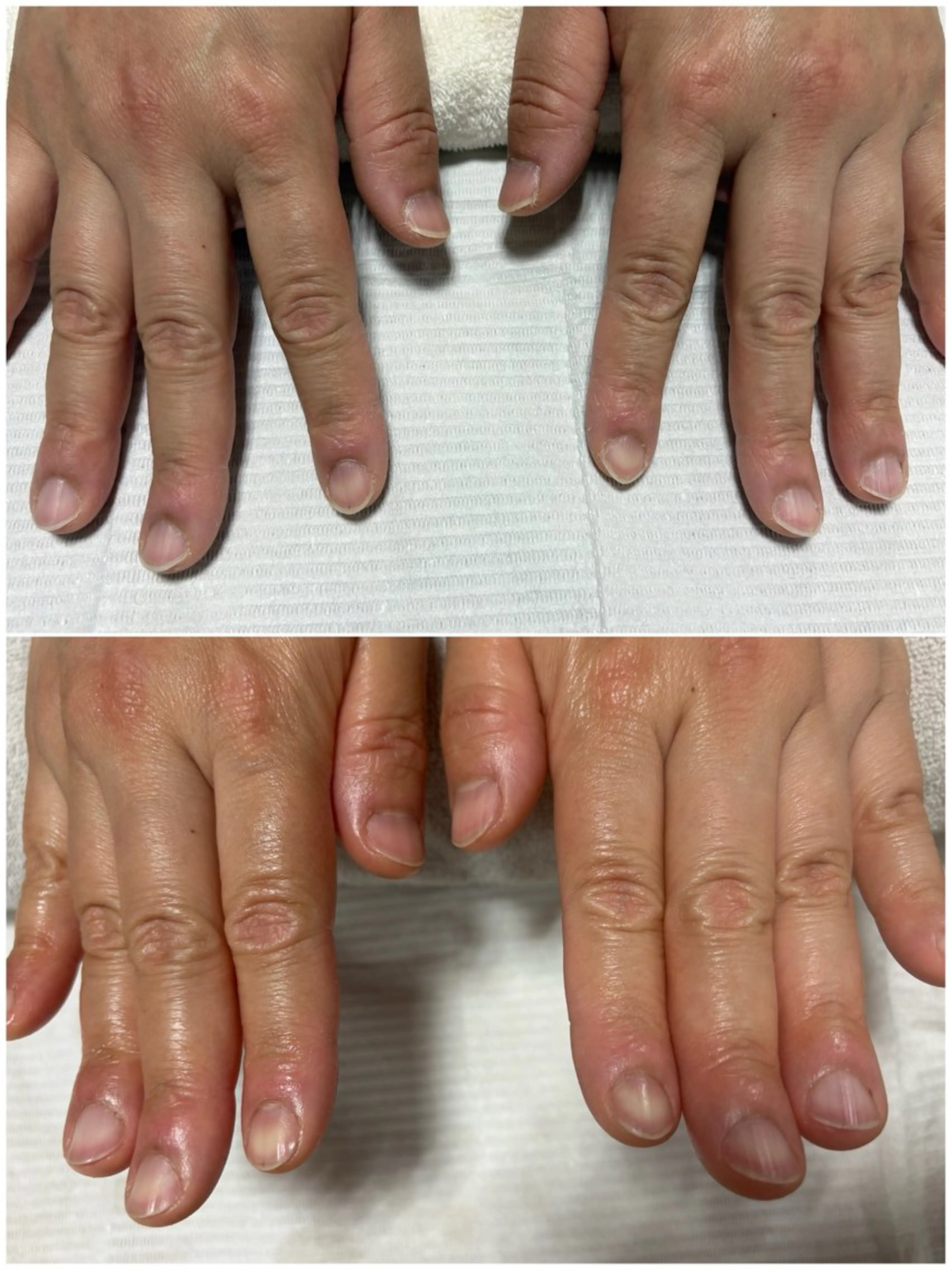 ハンドケアの写真