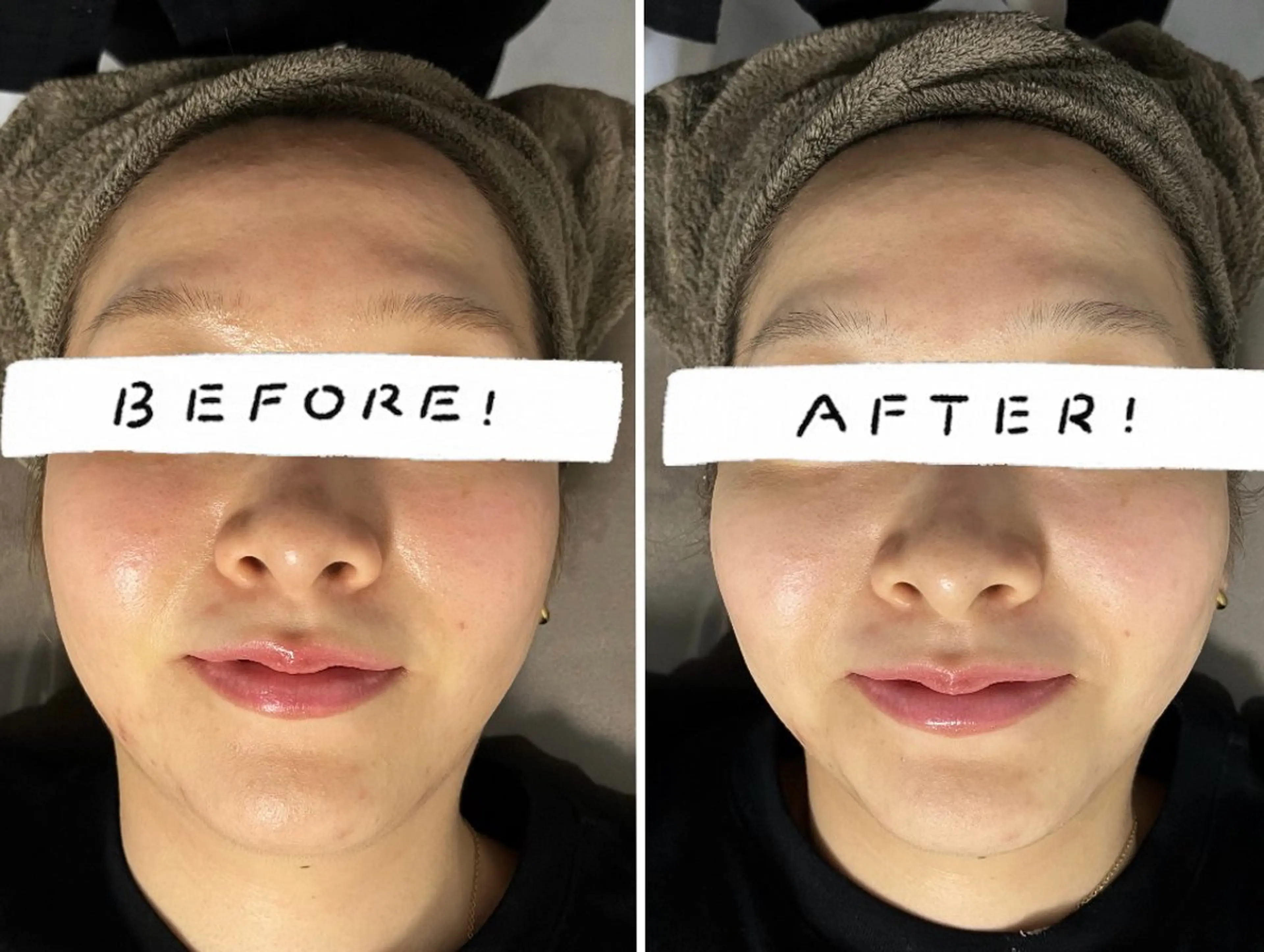 湘南エステサロン moaのエステ・リラクイメージ