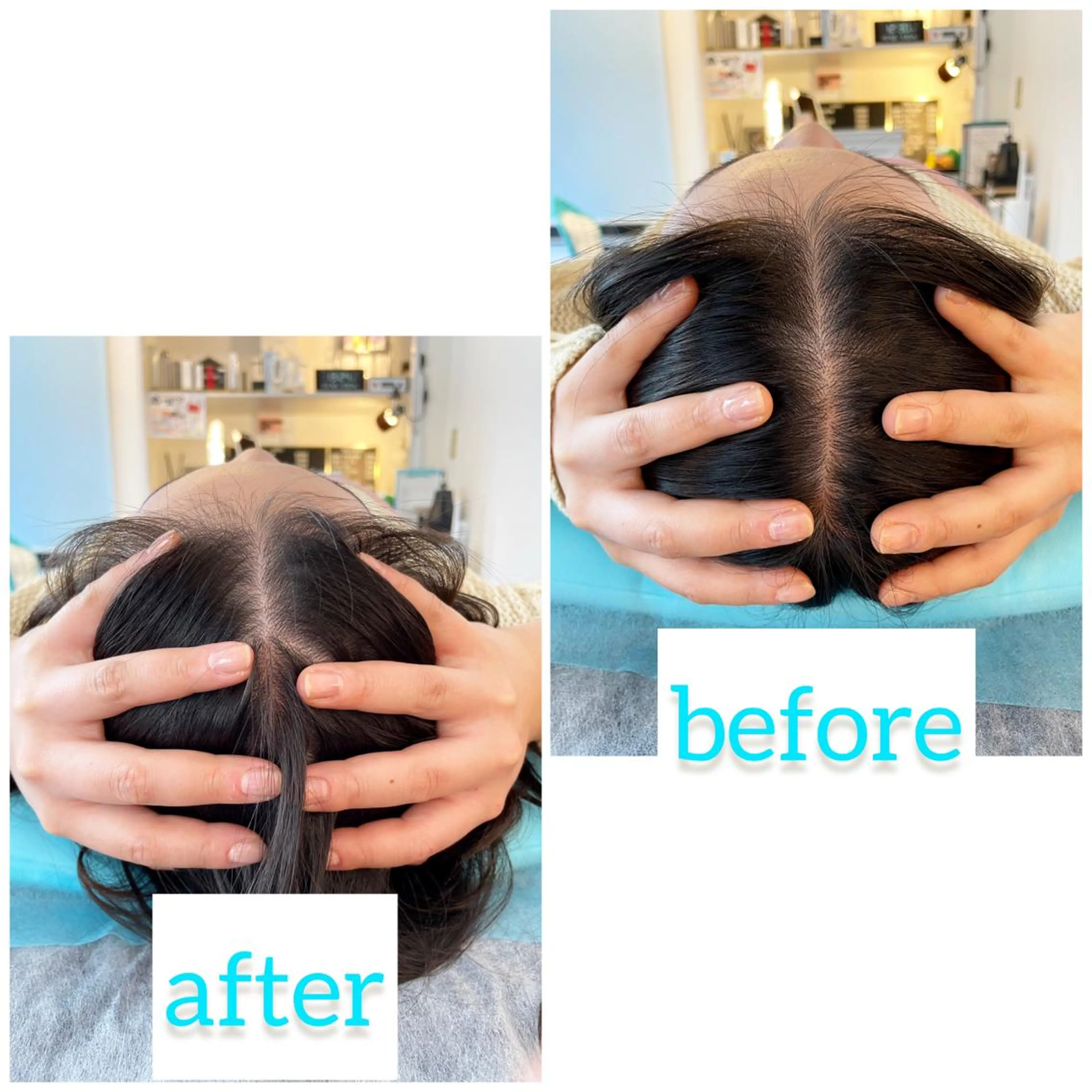 エステ リラク 小顔美容鍼専門サロン 渋谷YZのその他イメージ