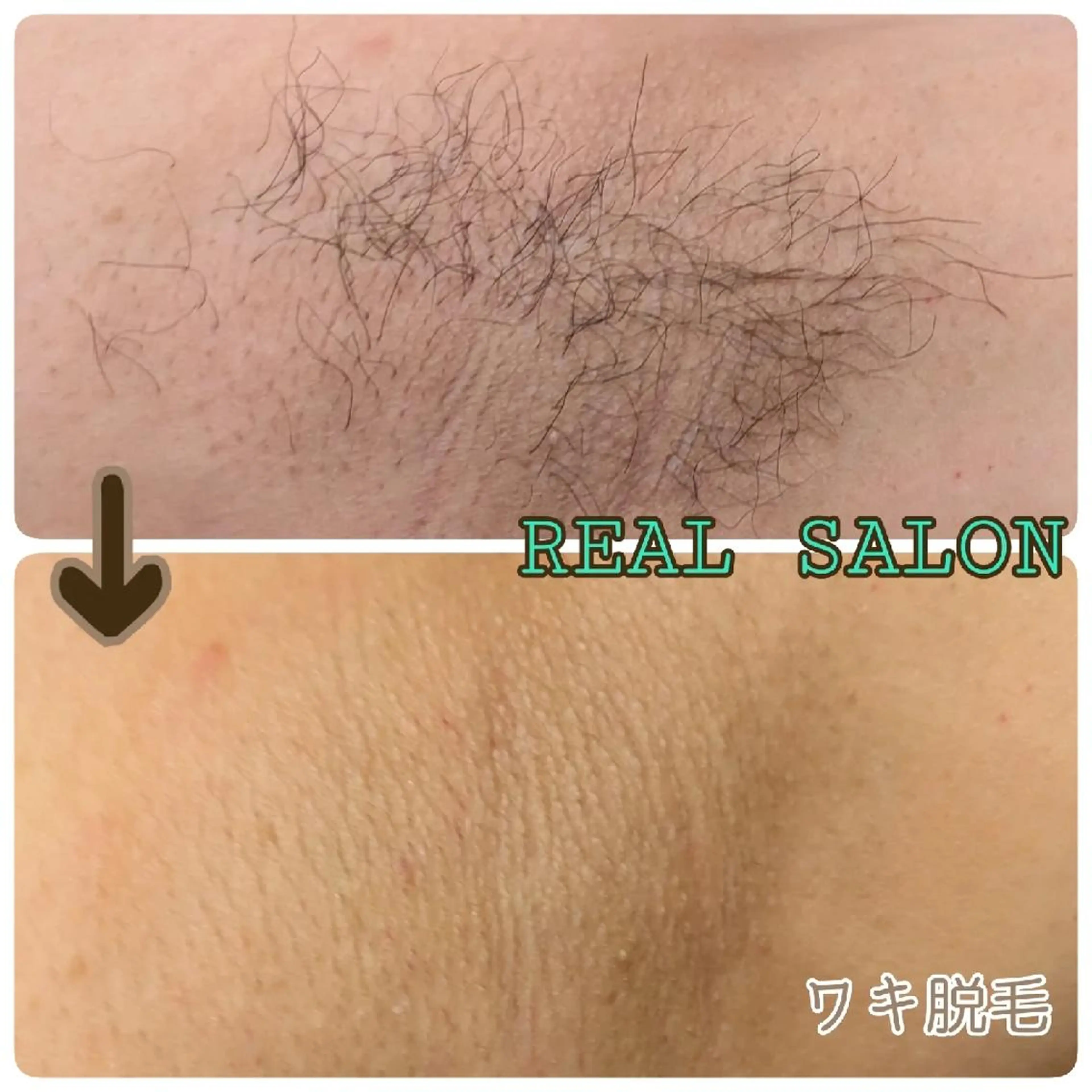 脱毛 レアルサロン　(脱毛サロン)所属・レアルサロン YUTAKAのエステ・リラクイメージ