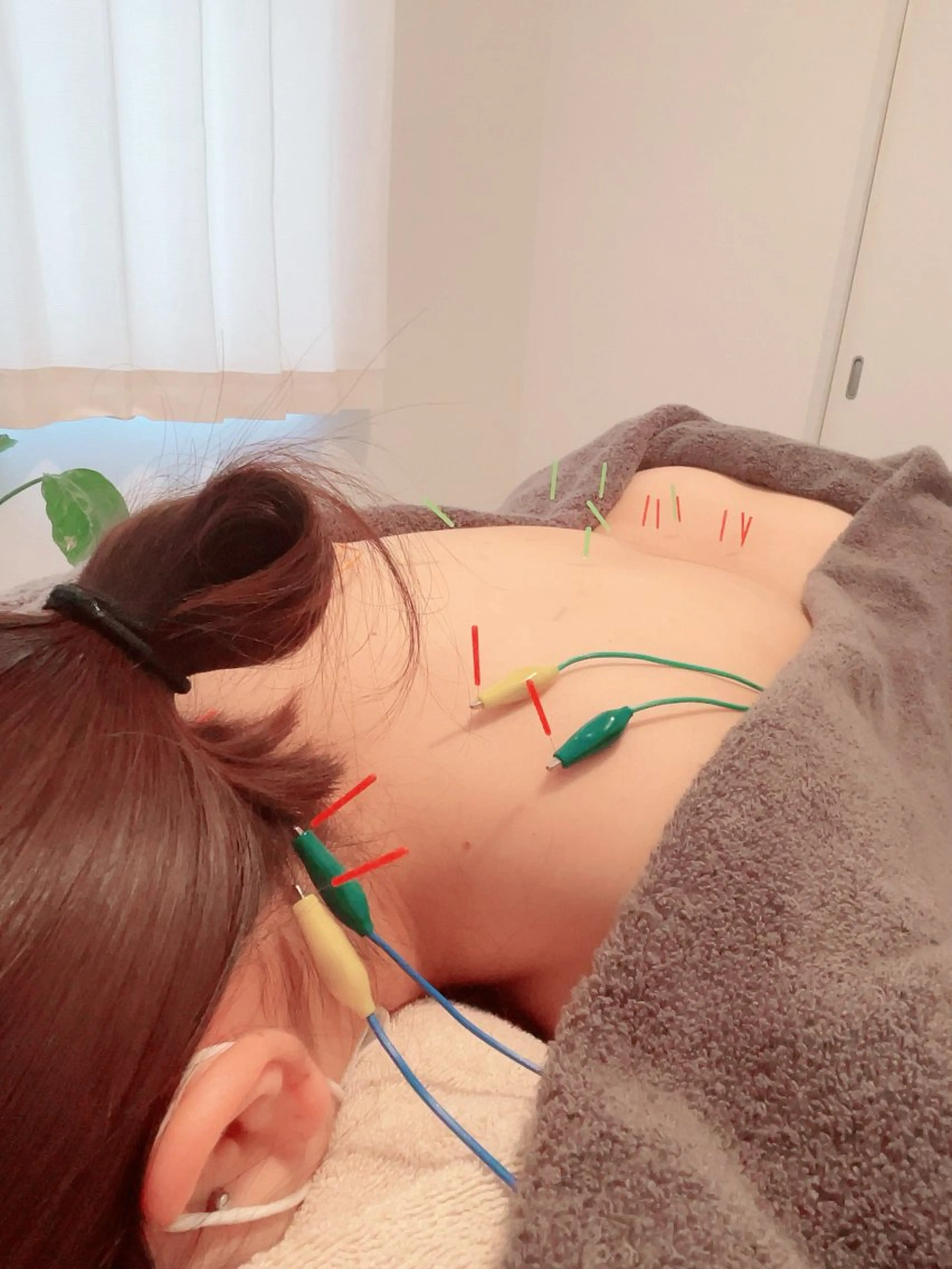 美容鍼＆鍼灸サロン 鍼Glitter.所属・田中 美奈のエステ・リラクイメージ