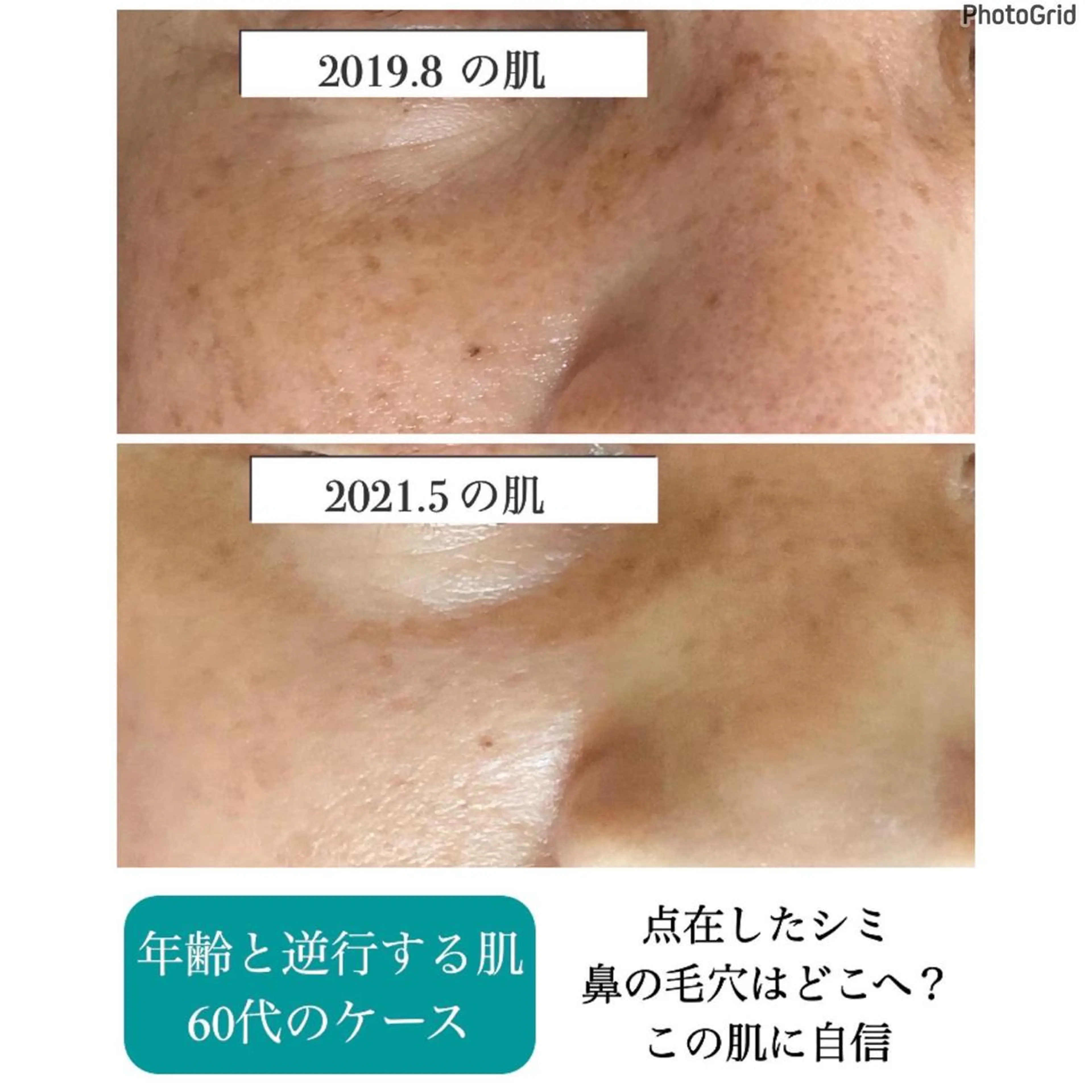 プチアンジェ所属・艶肌&小顔リフト❤︎ プチアンジェ茅ヶ崎のエステ・リラクイメージ