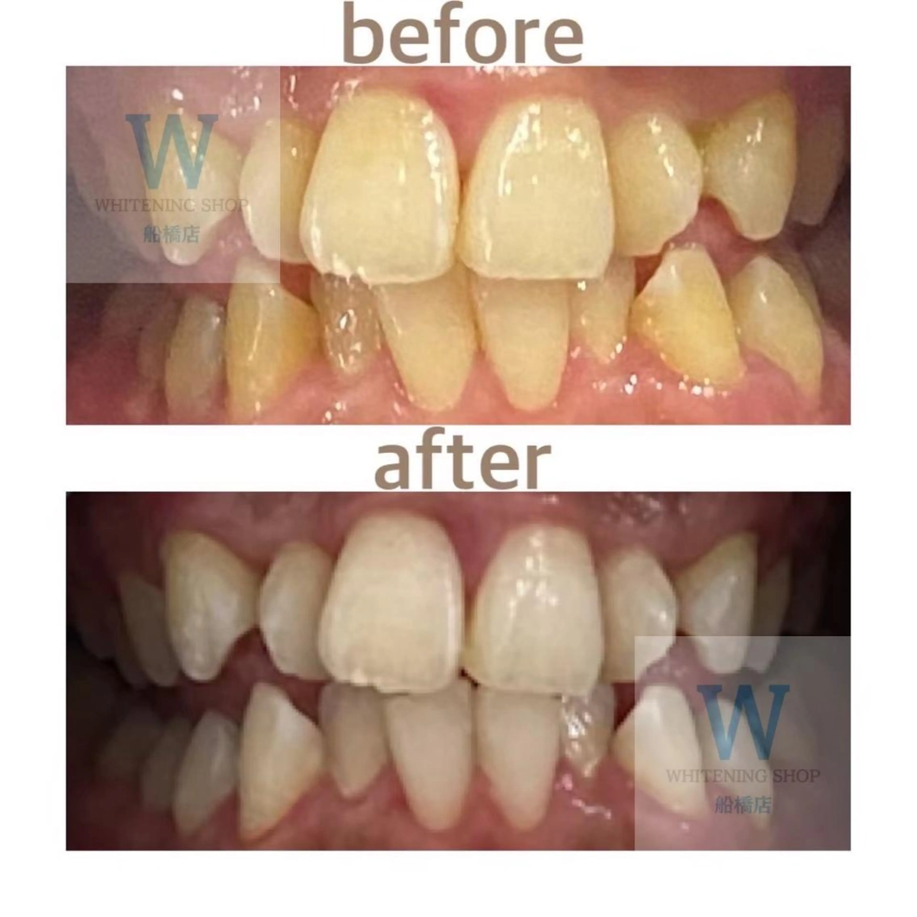 ホワイトニング ショップ船橋２号店のエステ・リラクイメージ