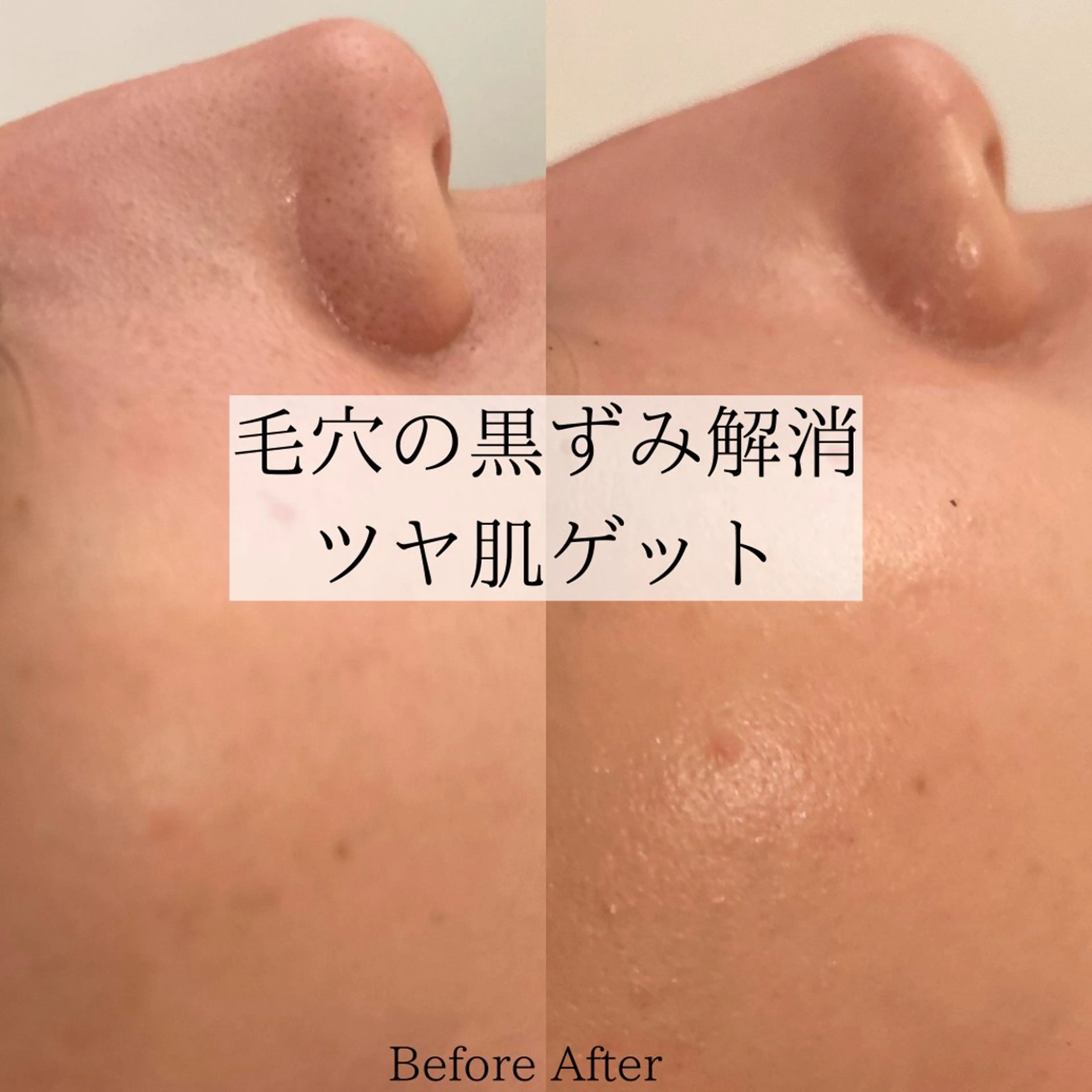 エステ Ginza Charerのエステ・リラクイメージ