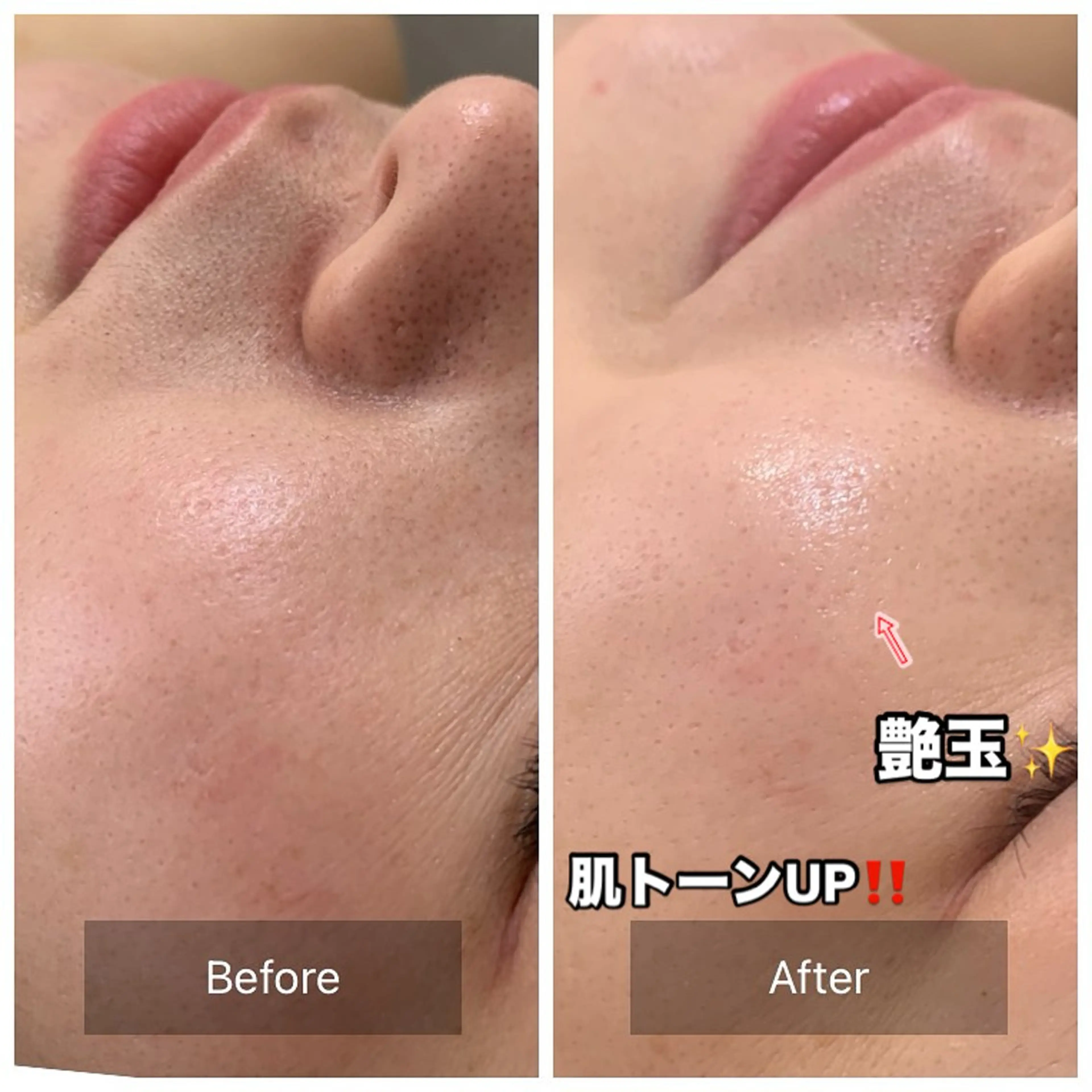 one day所属・肌質改善ハーブサロン ALA原宿のエステ・リラクイメージ