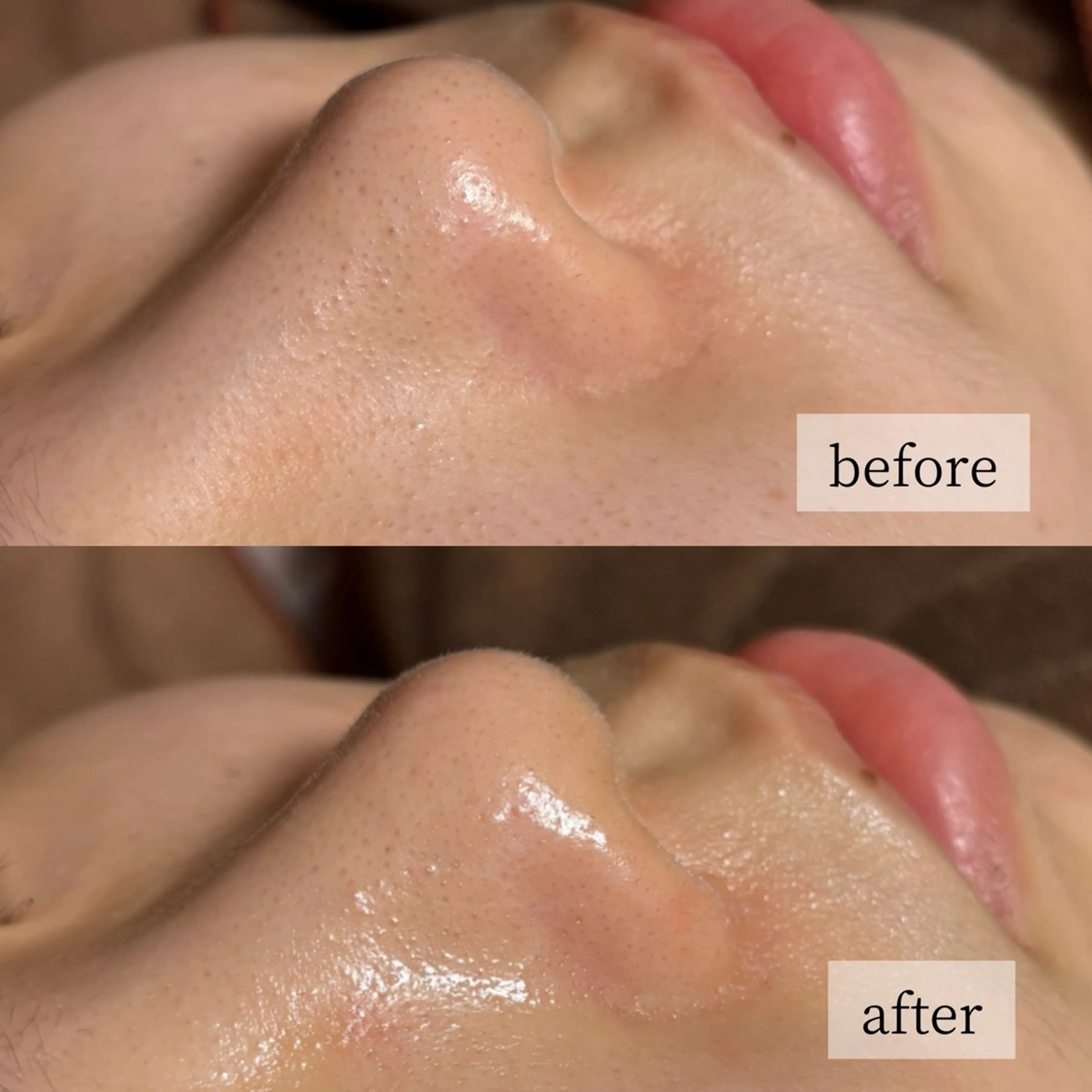 エステ HINANO矢場町店【ヒナノ】所属・脱毛/肌改善🌿 HINANO 村田のエステ・リラクイメージ