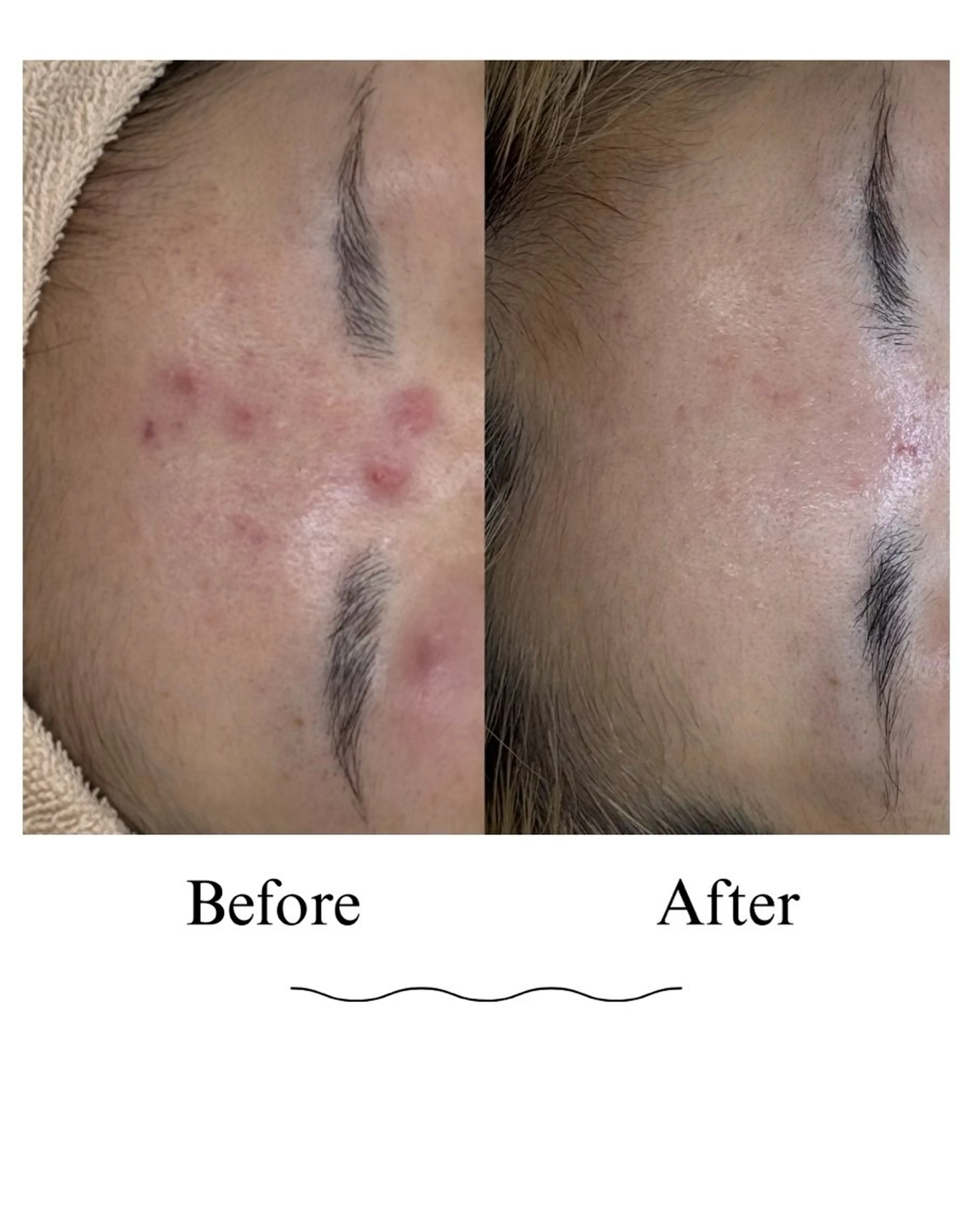 すっぴんでも怖くない肌作りの写真