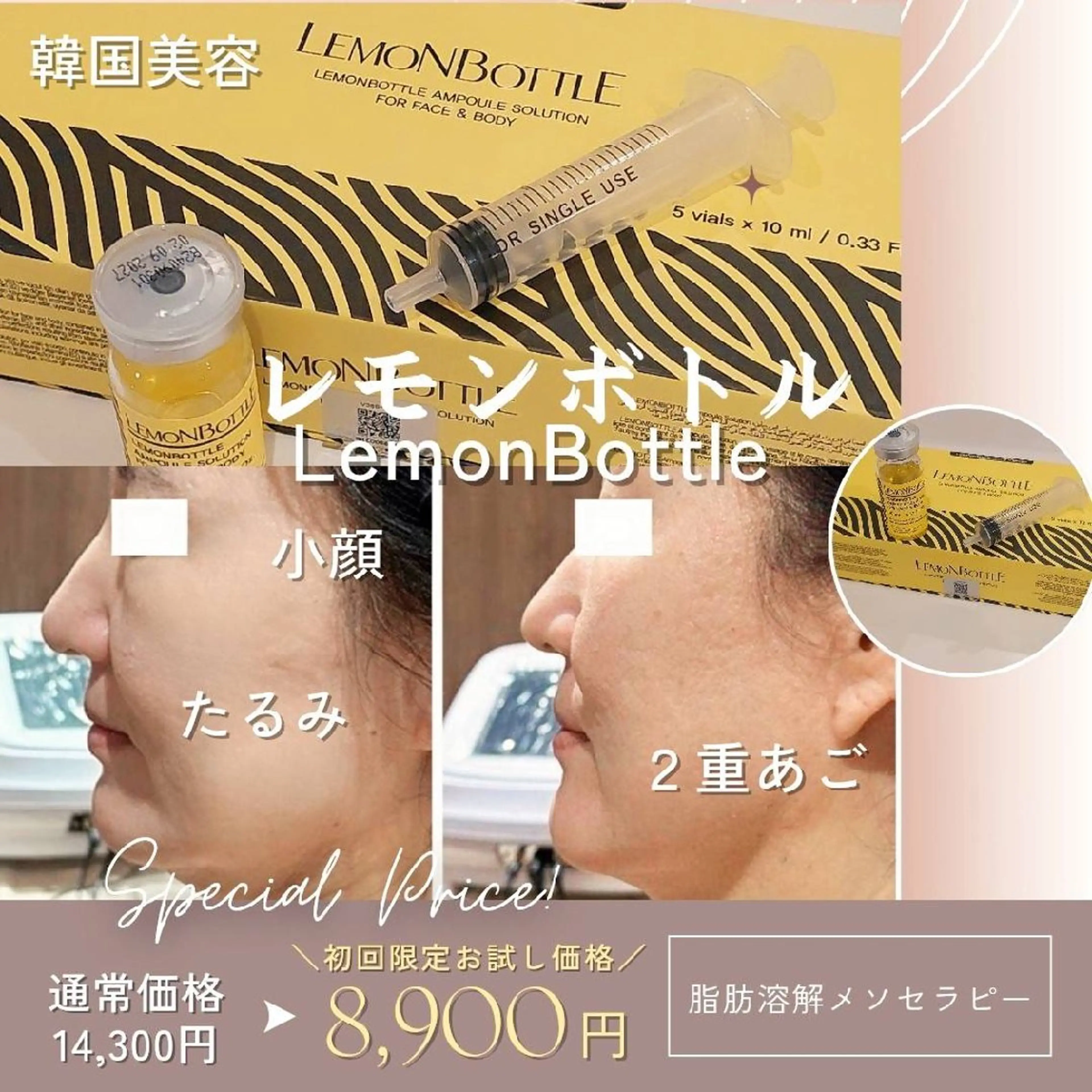 エステ MyFairLady miuのエステ・リラクイメージ