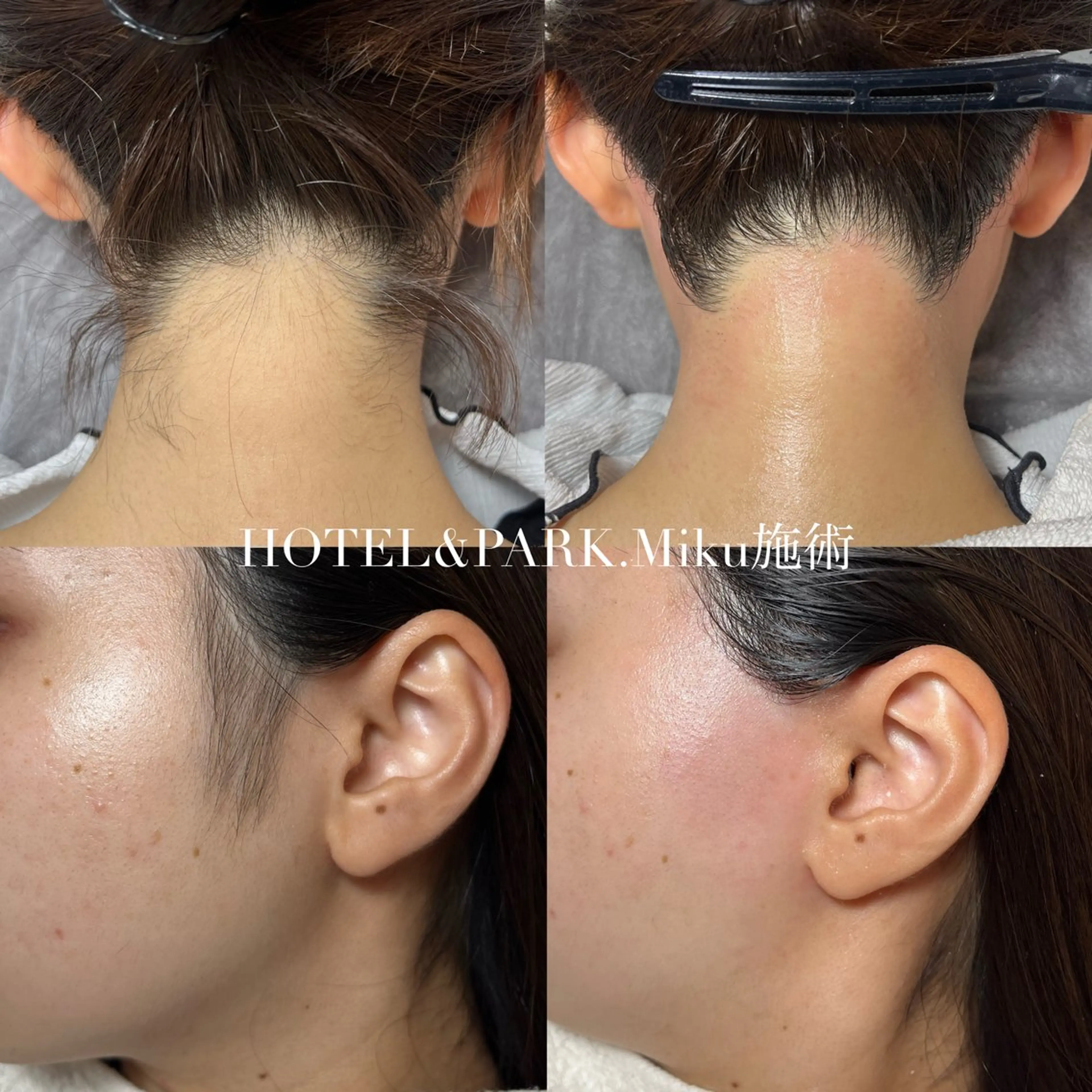 HOTEL&PARK Mikuワックス脱毛のエステ・リラクイメージ