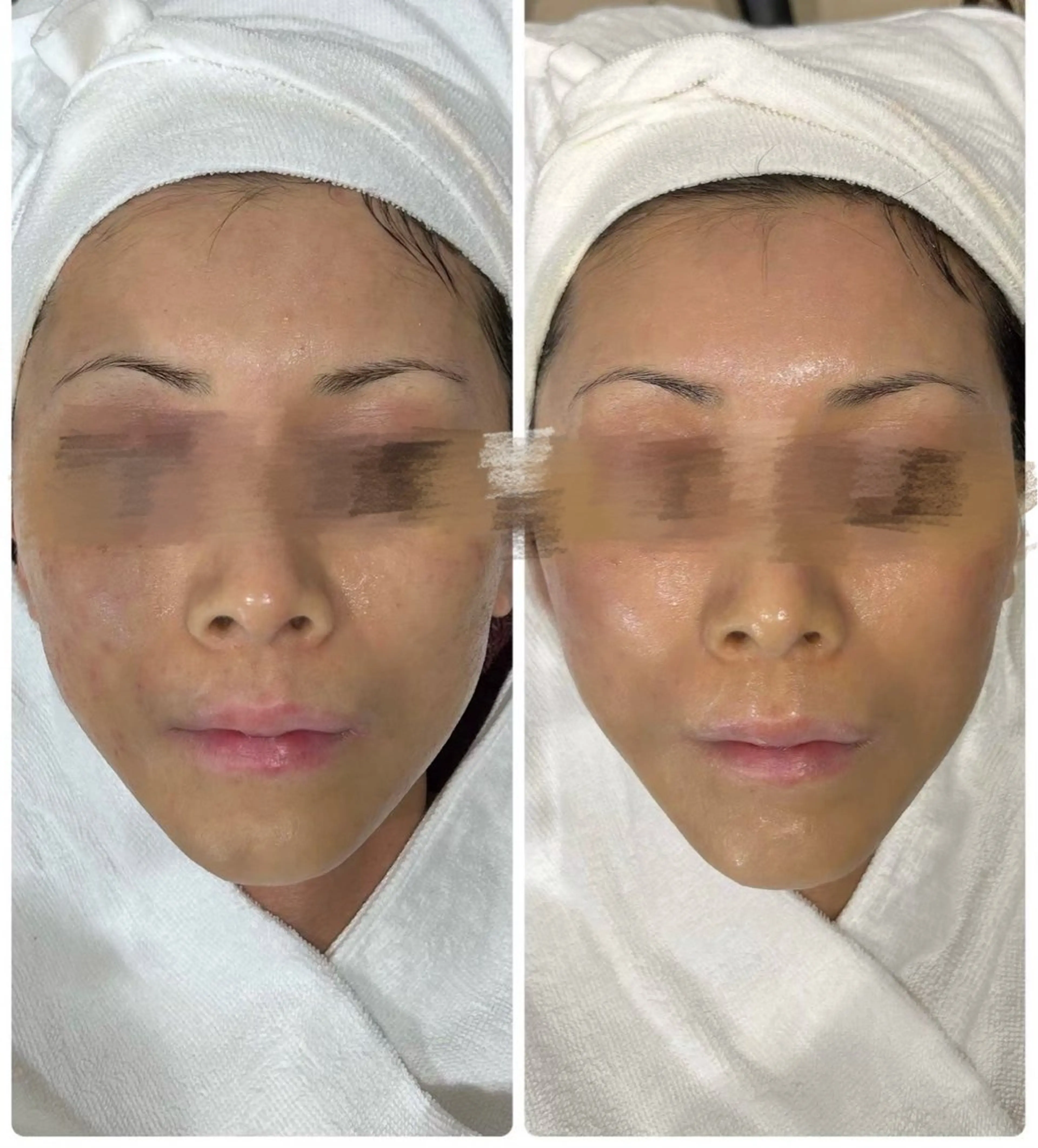 エステ ˚⟡ suwan .˚⟡のエステ・リラクイメージ