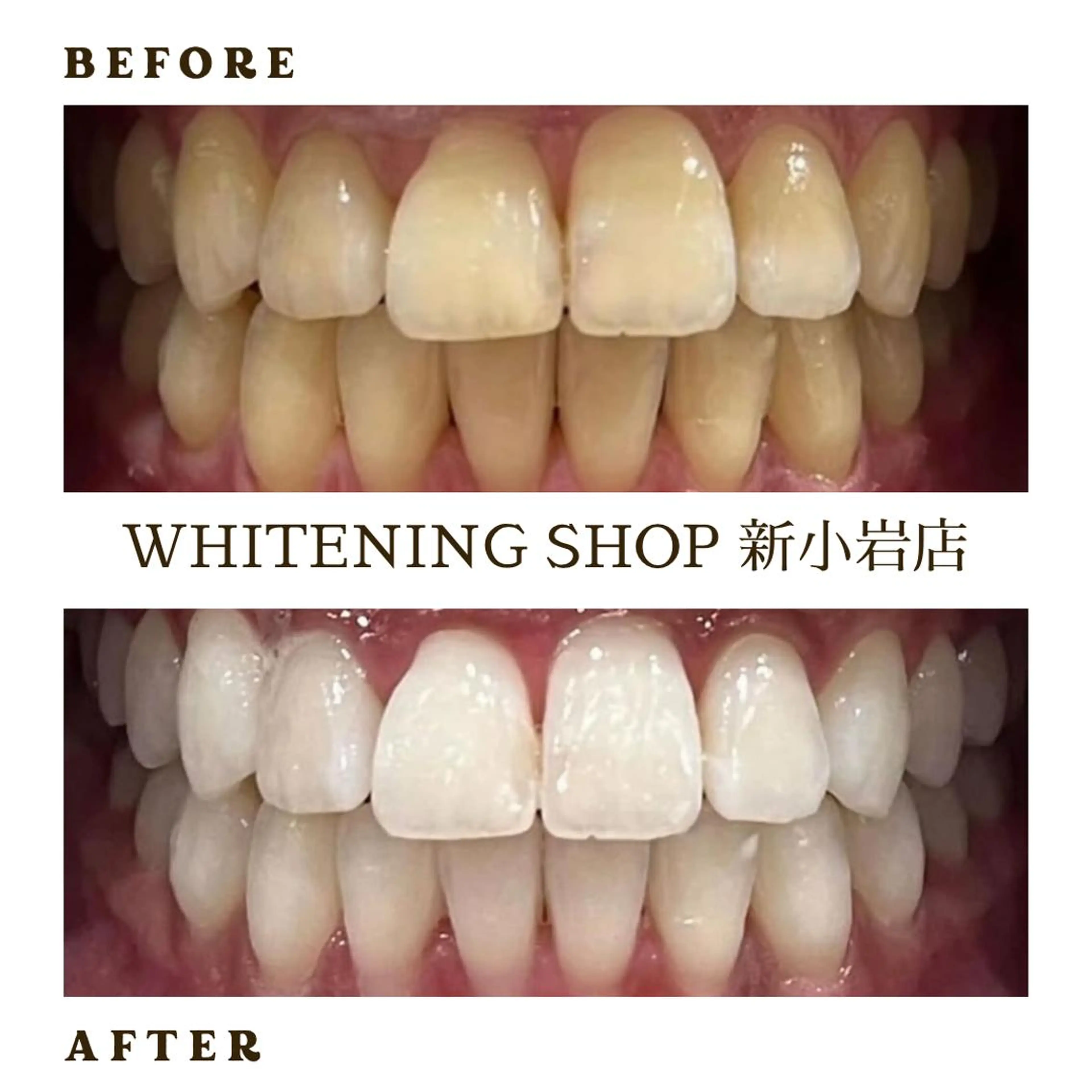 メンズ その他 ホワイトニング ショップ新小岩店のその他イメージ