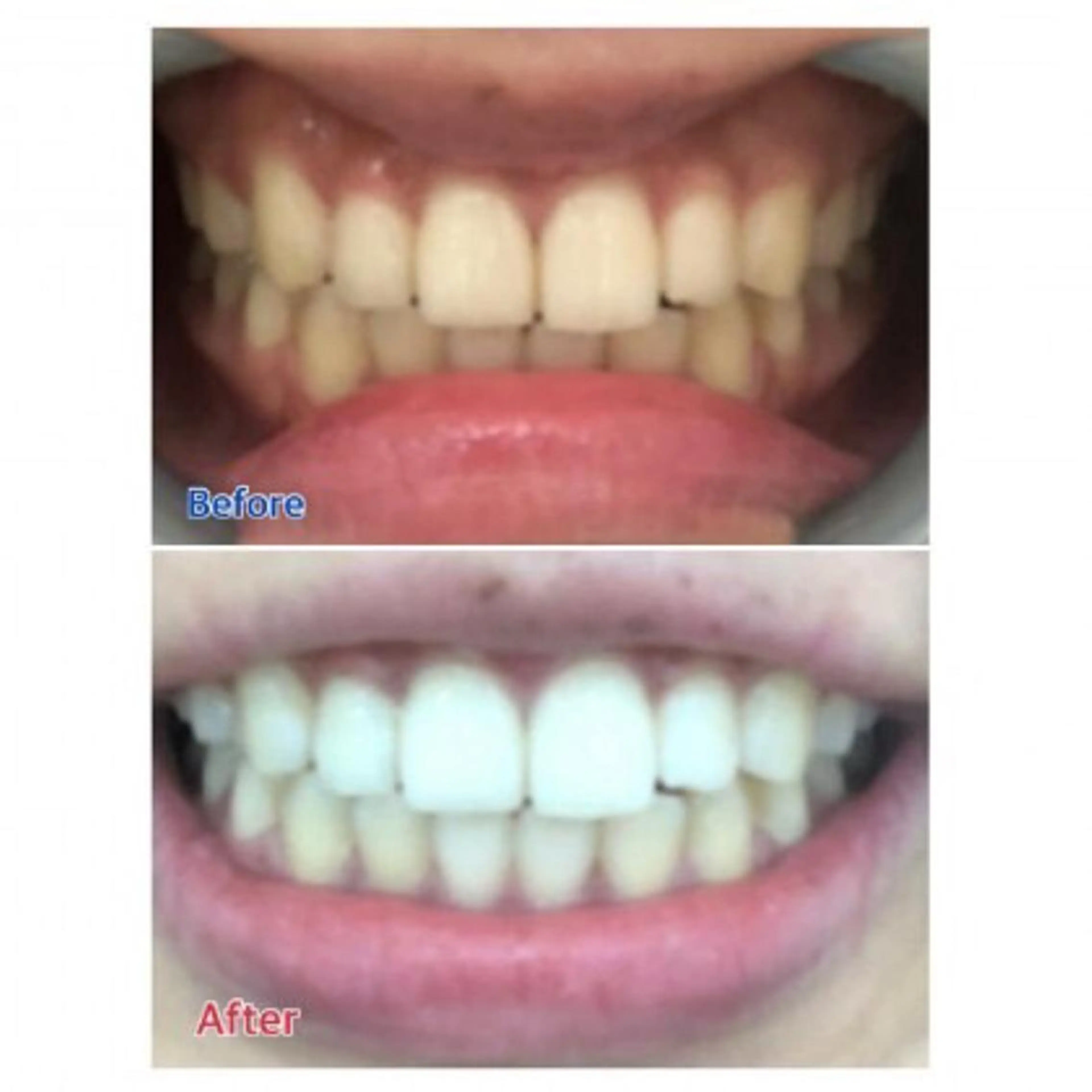 M渋谷店所属・Ｍ渋谷 ホワイトニングのエステ・リラクイメージ