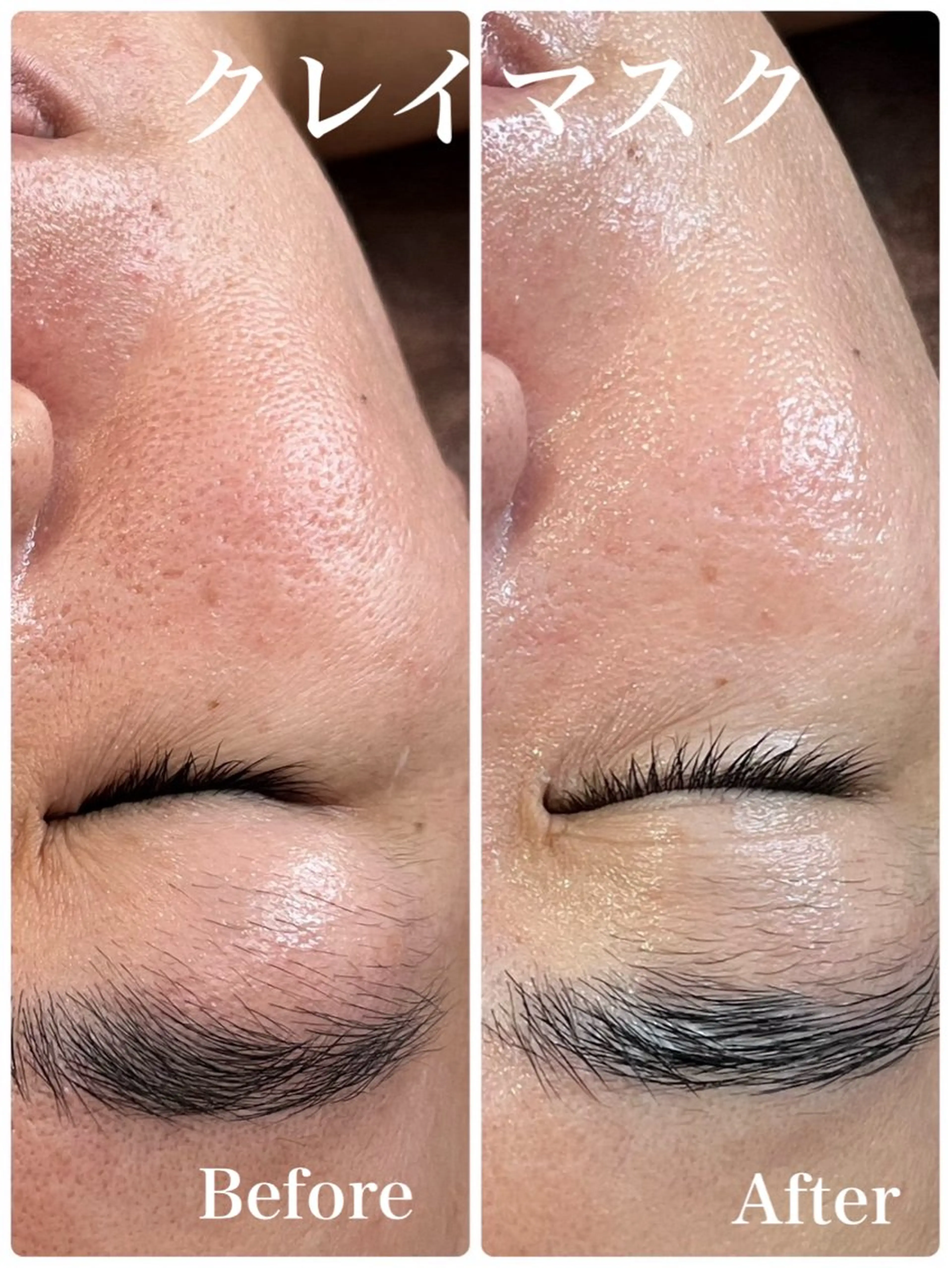 【デトックスエステ】クレンジング▶︎フェイシャルマッサージ▶︎リンパ促進▶︎毛穴吸引▶︎石膏パック（60分）の写真