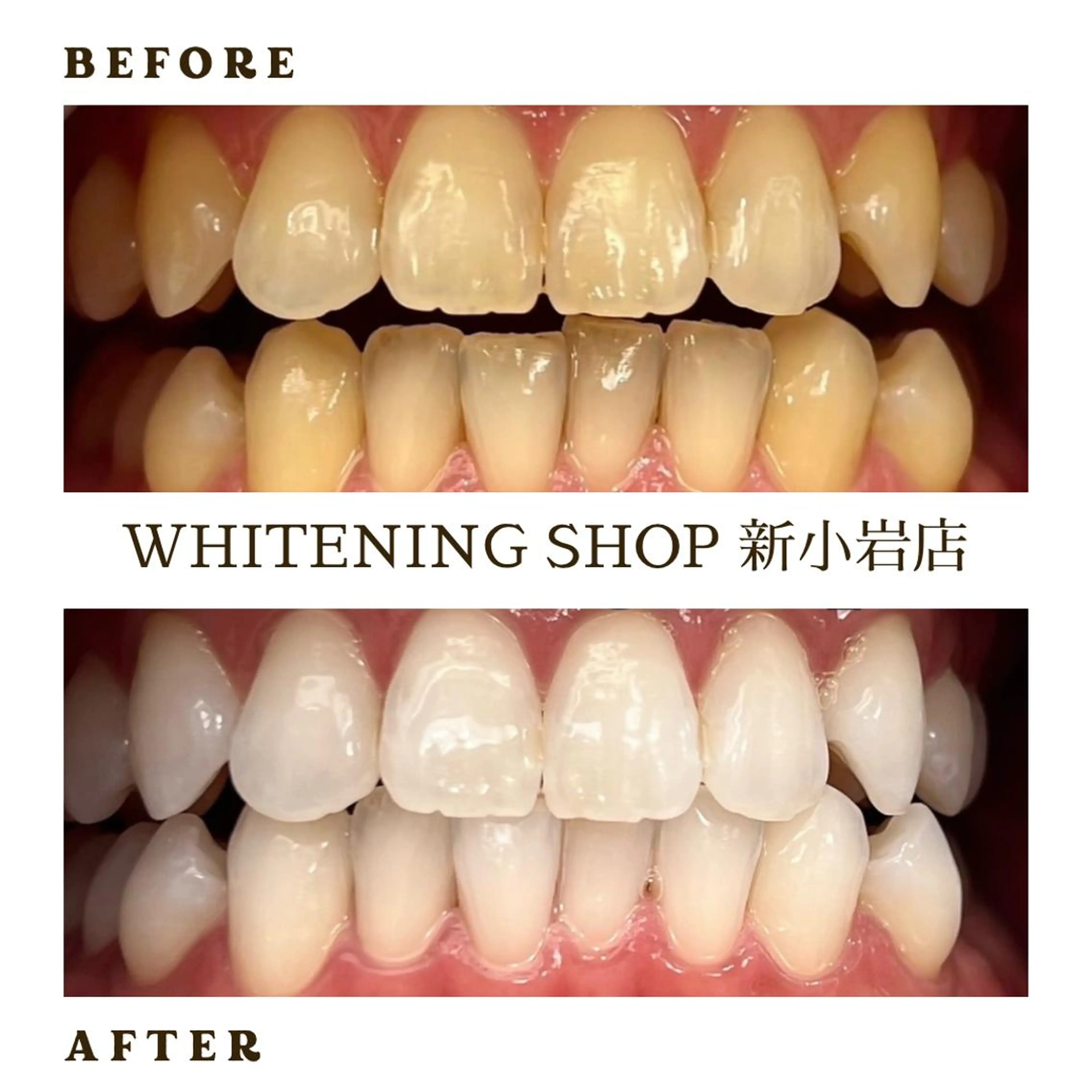 メンズ その他 ホワイトニング ショップ新小岩店のその他イメージ