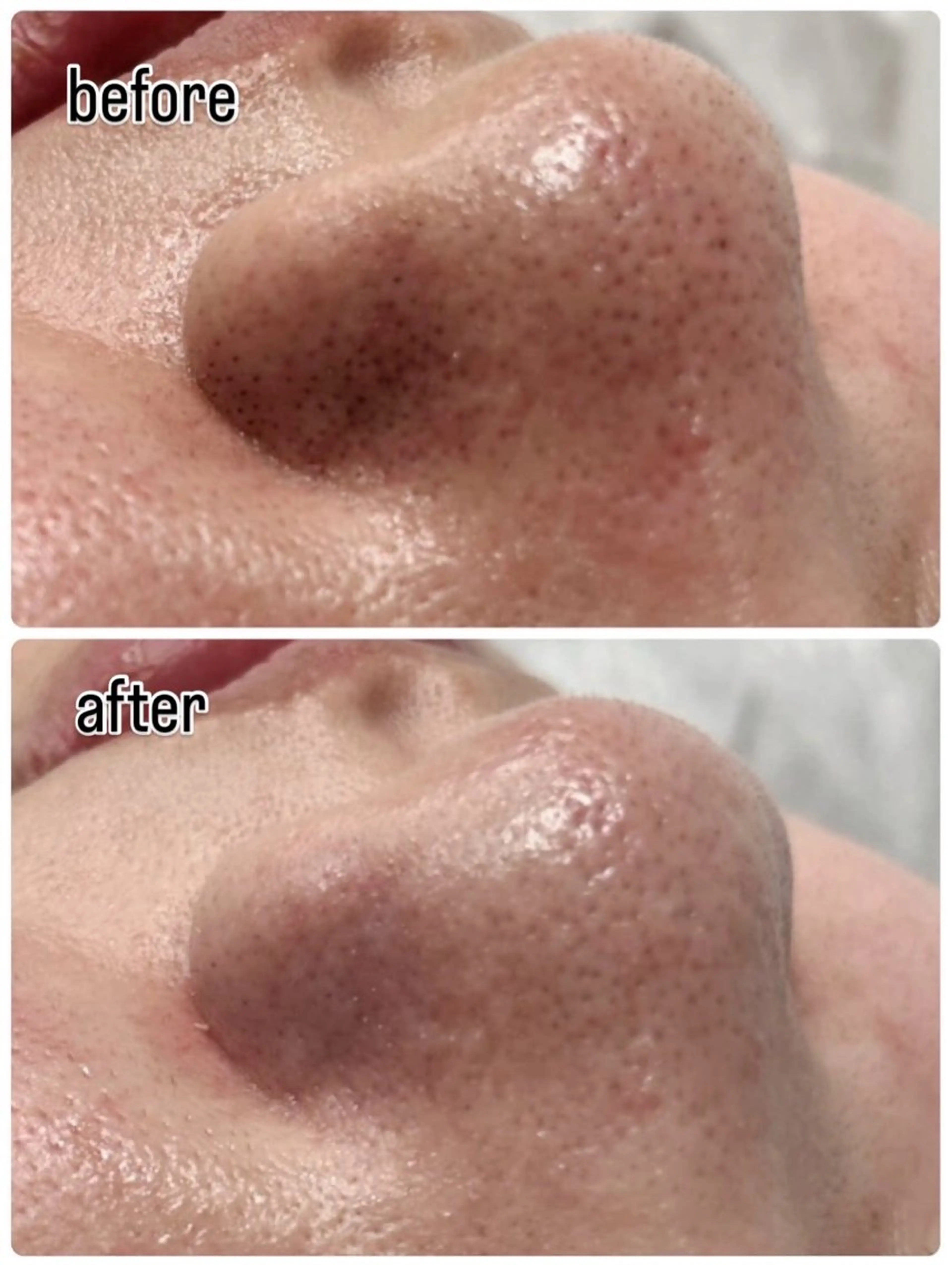 DISINI  SPA所属・DISINISPA 脱毛/フェイシャルのエステ・リラクイメージ