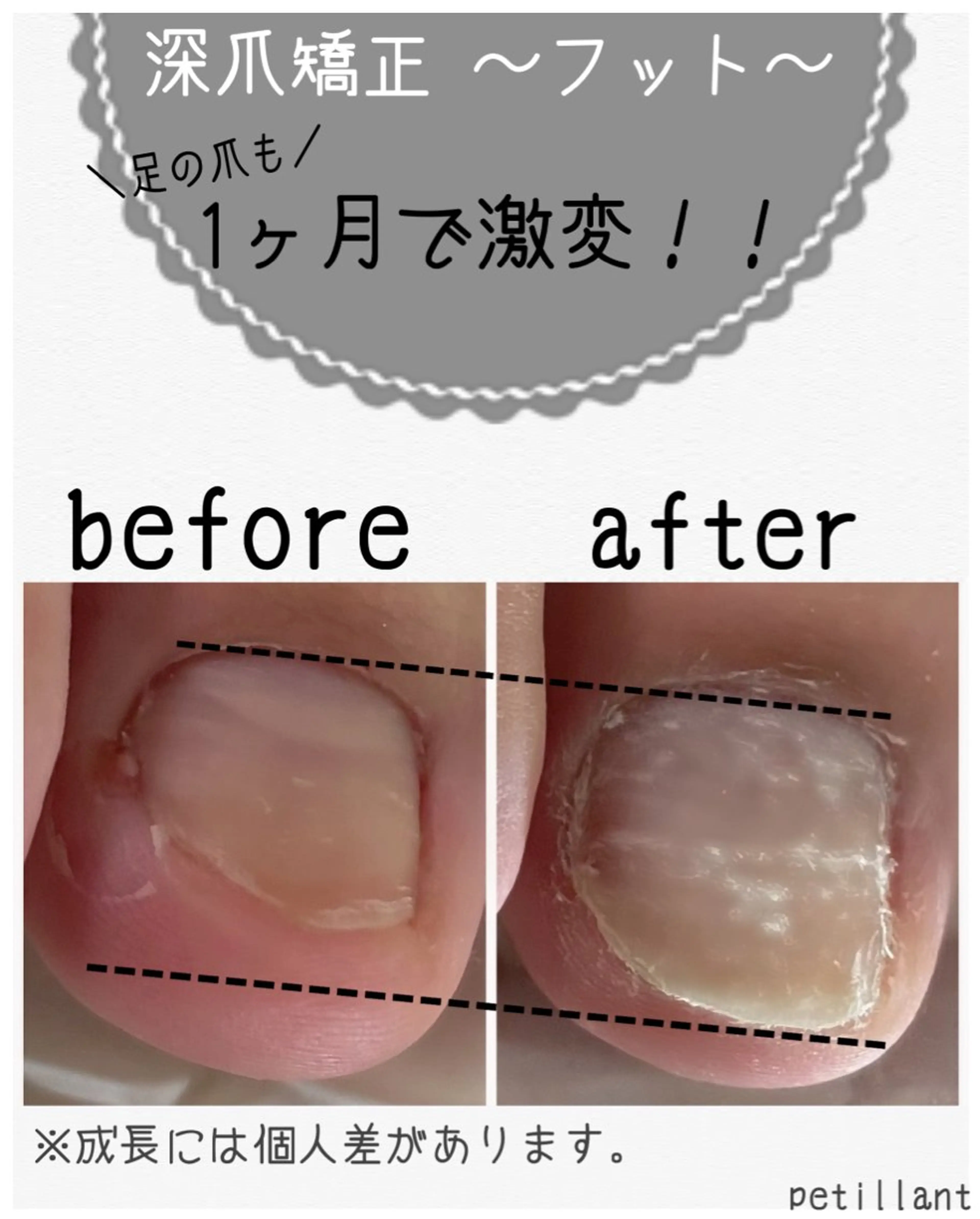 ネイル フットネイル ジェルネイル petillant所属・nail salon petillantのネイルデザイン