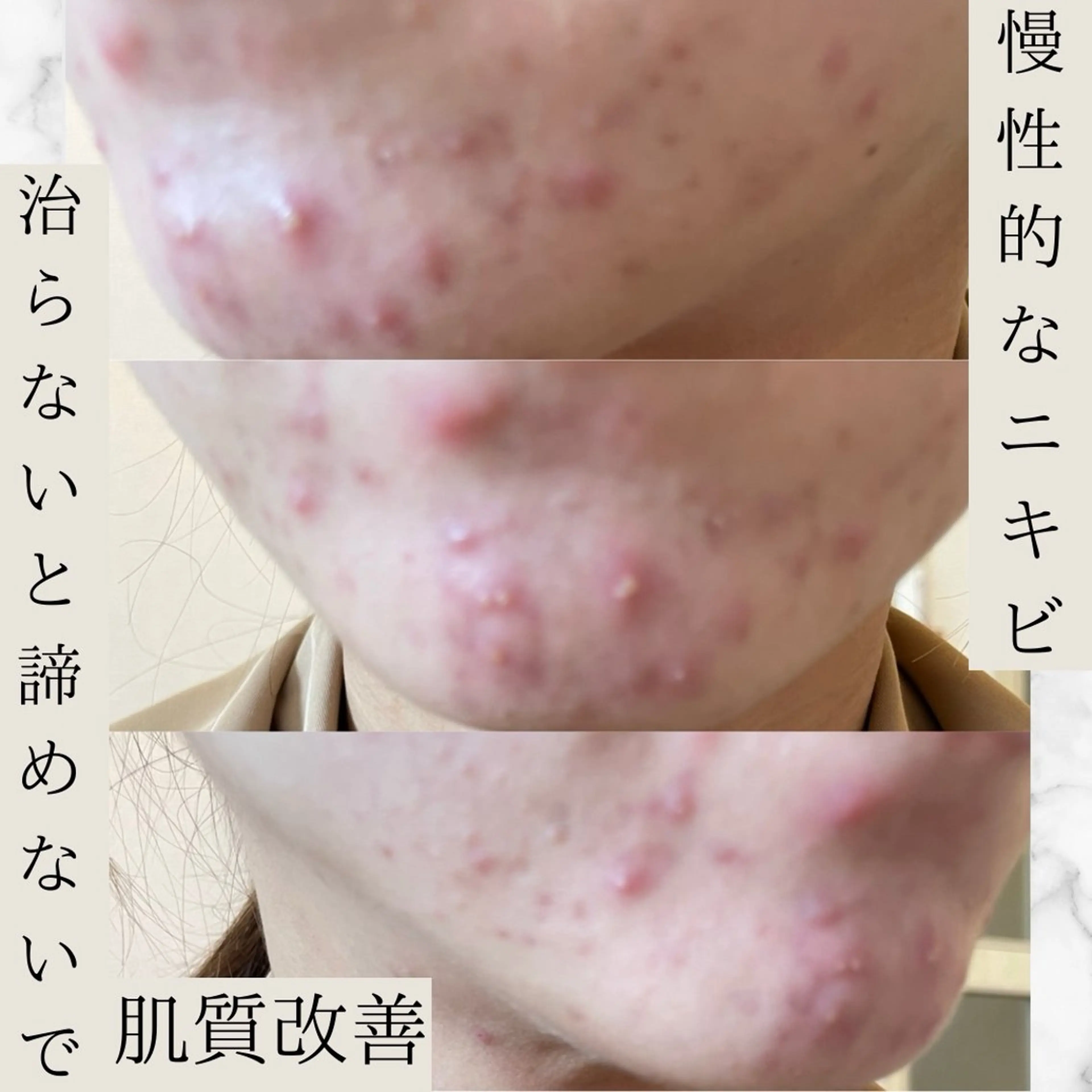 Ginza Charerのエステ・リラクイメージ