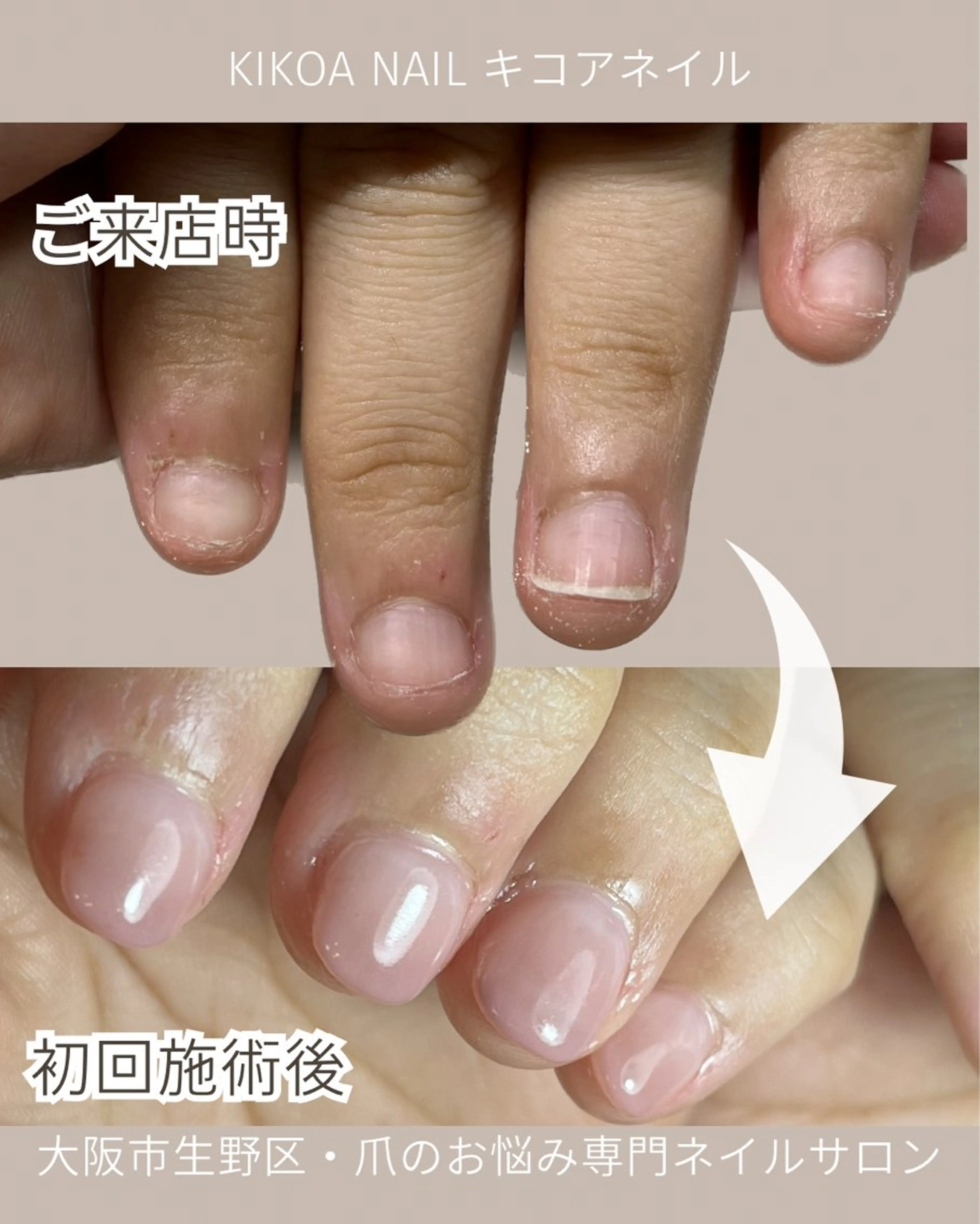 ネイル ピンク KIKOA NAIL キコアネイルのネイルデザイン