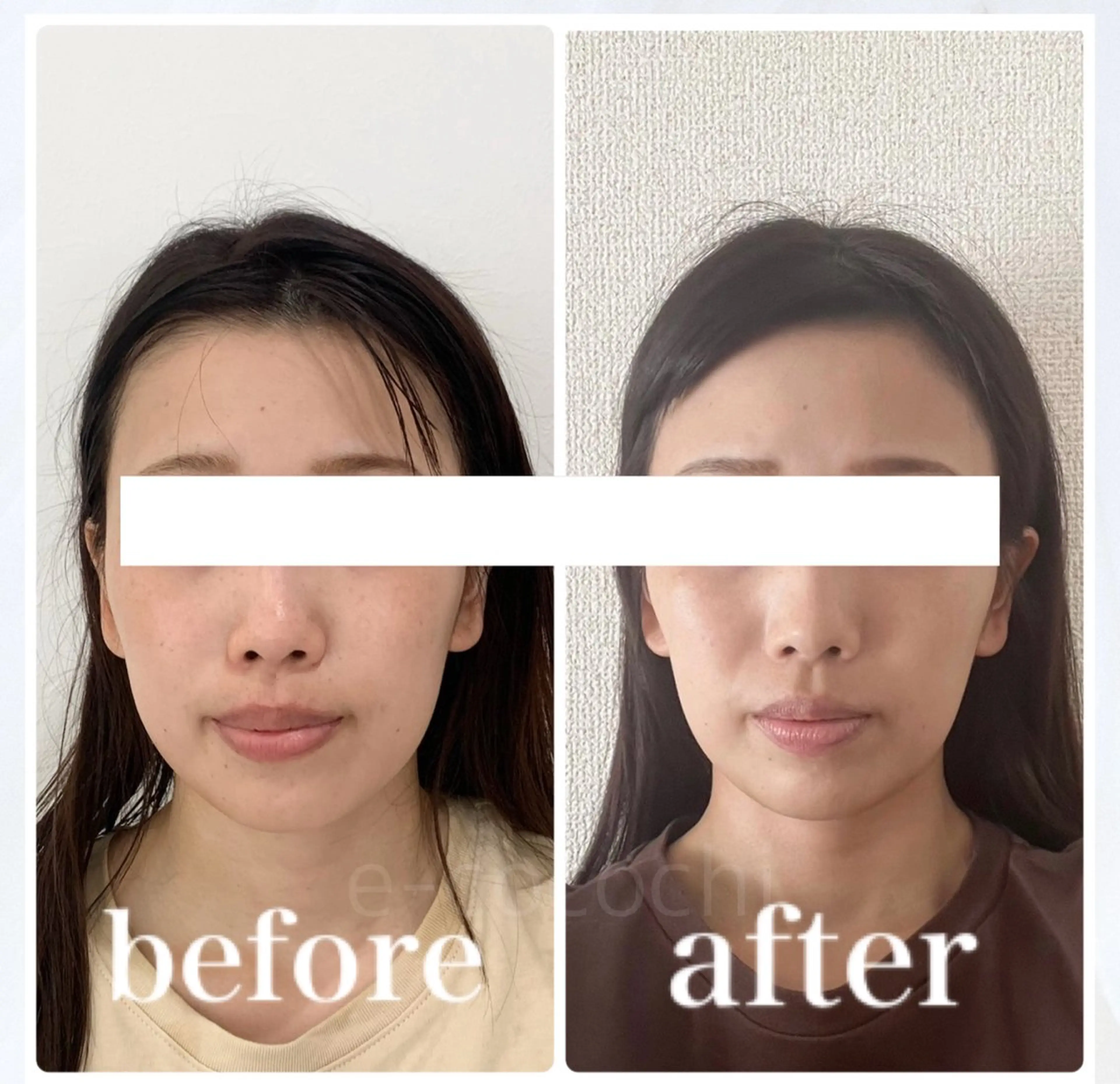 エステ リラク 小顔と ヘッドスパのお店のエステ・リラクイメージ