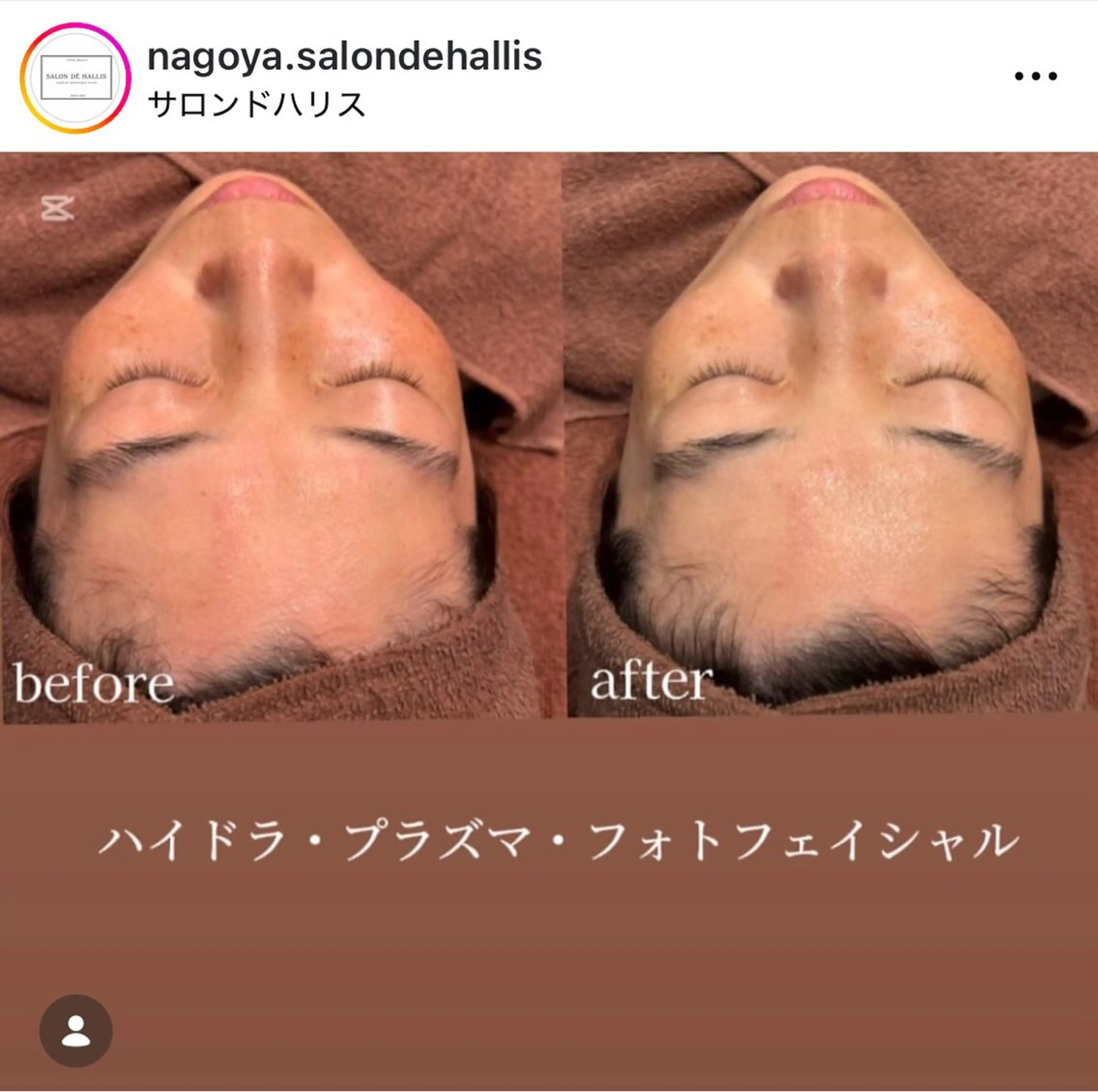 ✨️光フェイシャル✨️の写真