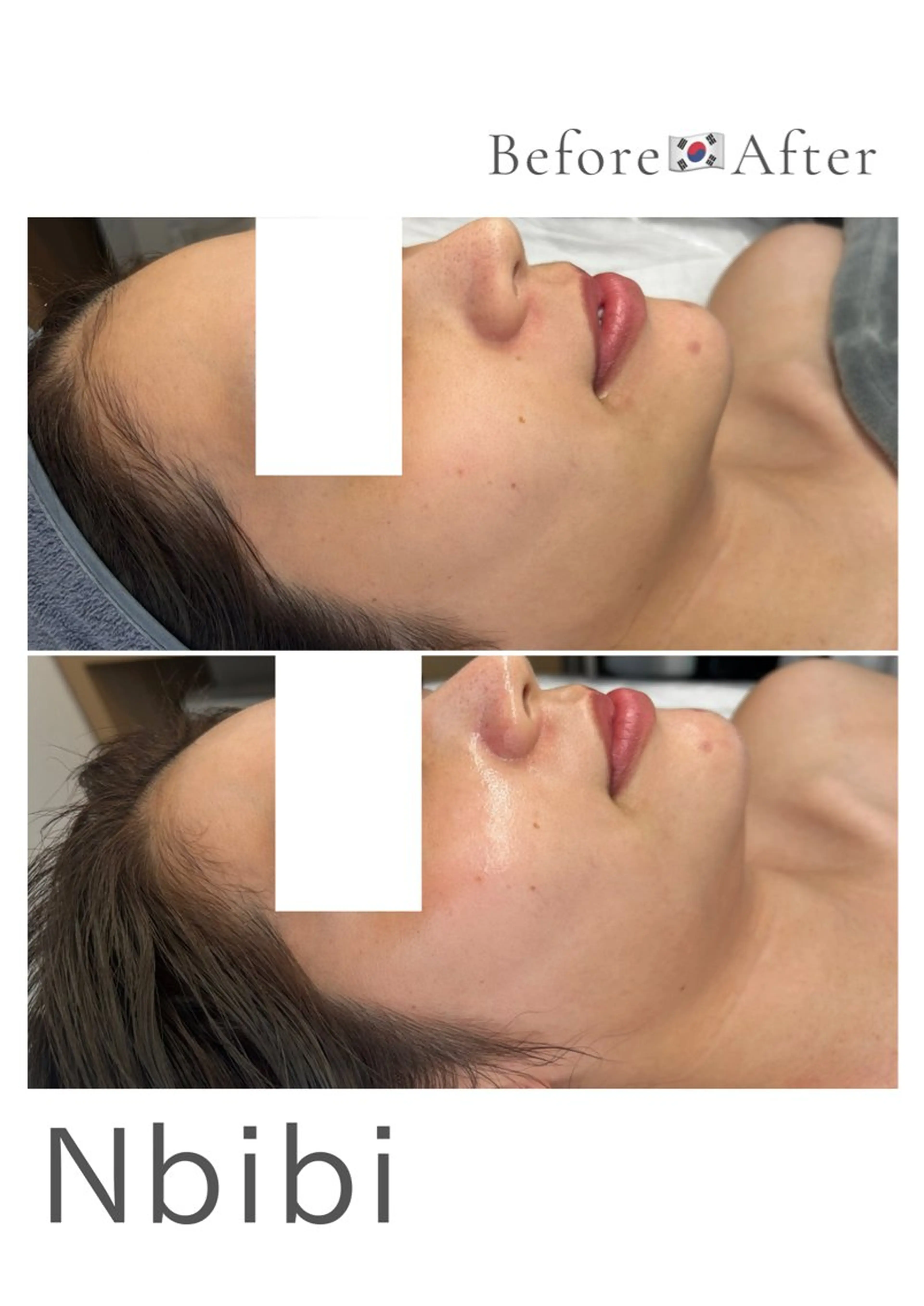 韓国🇰🇷価格 サロン_Nbibiのエステ・リラクイメージ