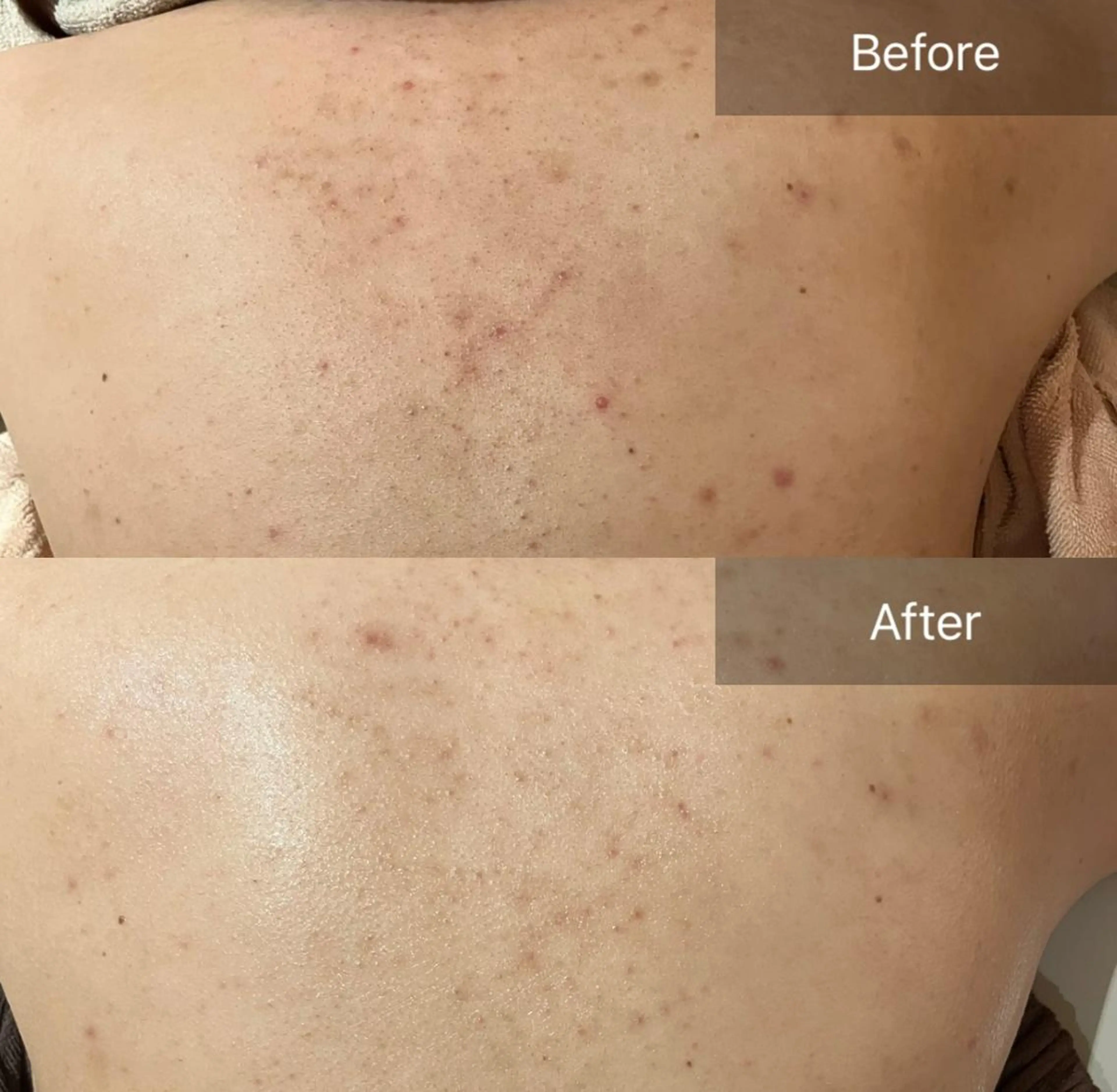 その他 for woman所属・森 美優のエステ・リラクイメージ