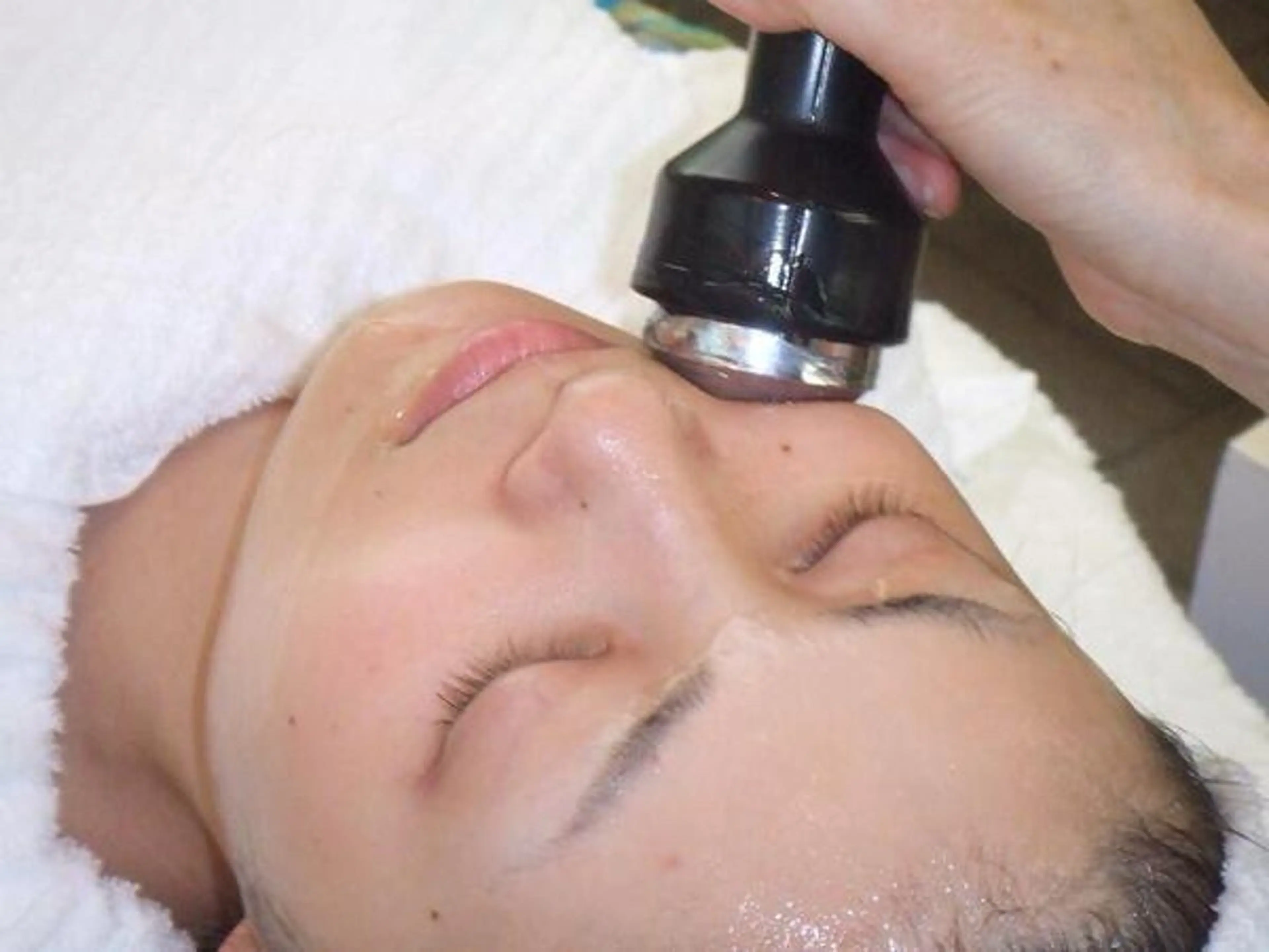 【小顔・引き締め特化】リフトアップコース💎の写真