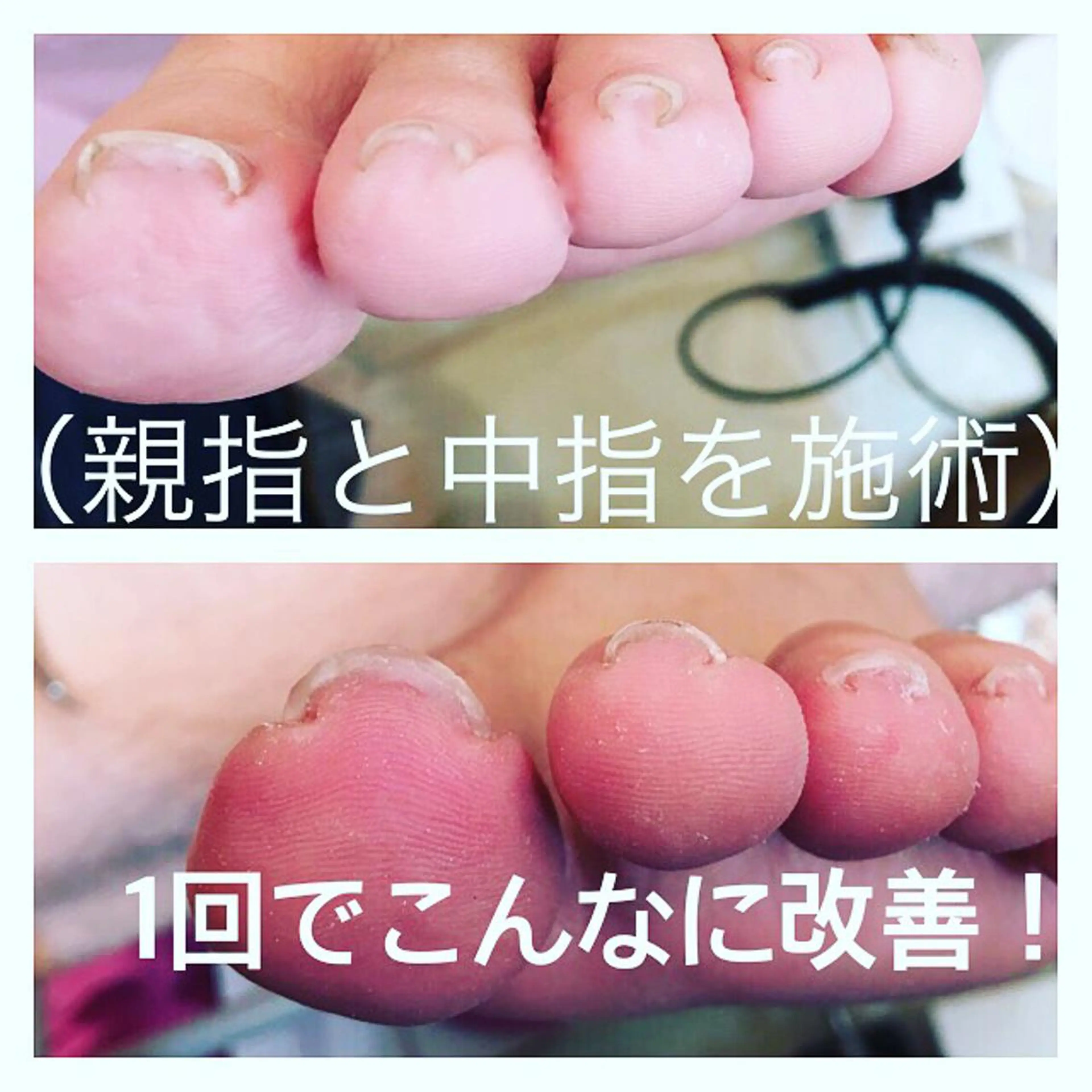 ショート カラー パーマ ヘアアレンジ メンズ キッズ ネイル マツエク・マツパ アートネイル ジェルネイル 夏ネイル NAILSGOGO shibuyaのネイルデザイン